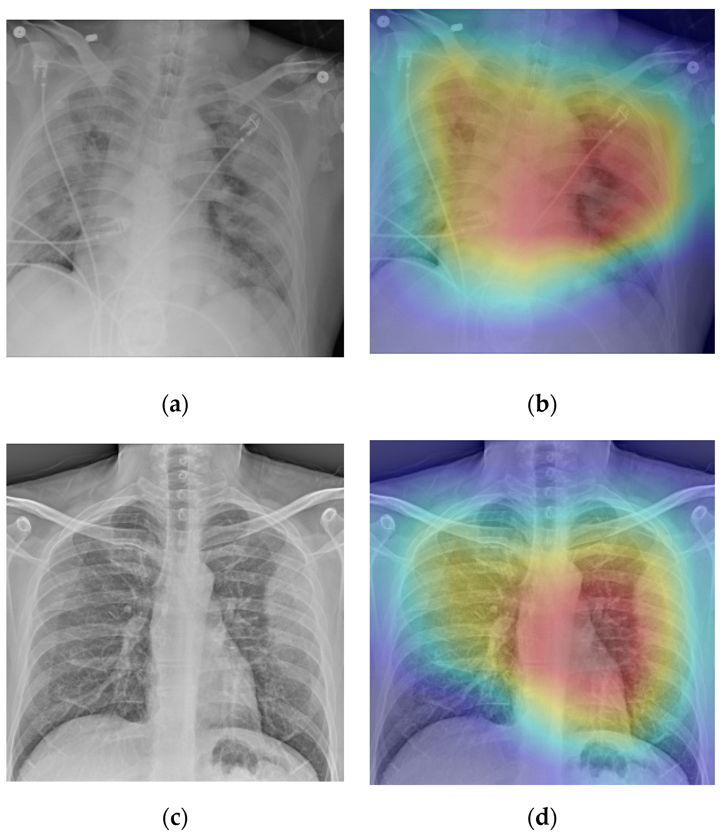 Mathematics Free Full Text Fast Covid 19 And Pneumonia Classification Using Chest X Ray Images Html