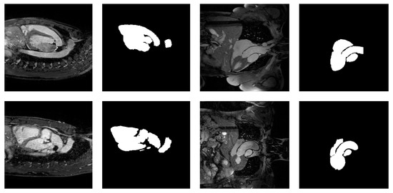Mathematics Free Full Text Feasibility Of Automatic Seed Generation Applied To Cardiac Mri Image Analysis Html Mathematics Free Full Text Feasibility Of Automatic Seed Generation Applied To Cardiac Mri Image Analysis Html
