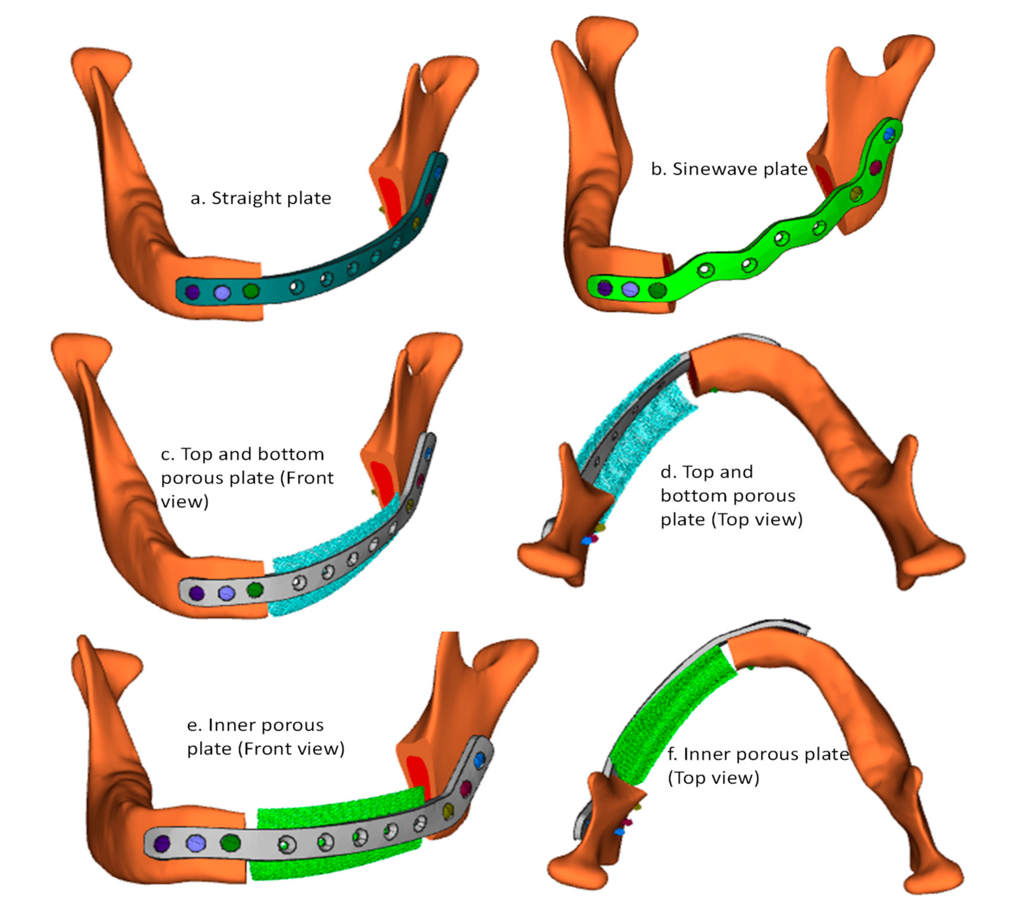 Mathematics 08 02121 g004