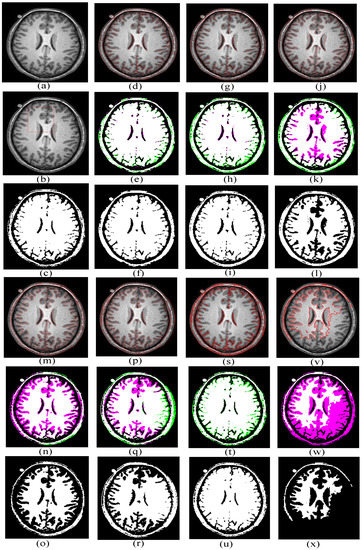 A New Active Contour Medical Image Segmentation Method Based on ...