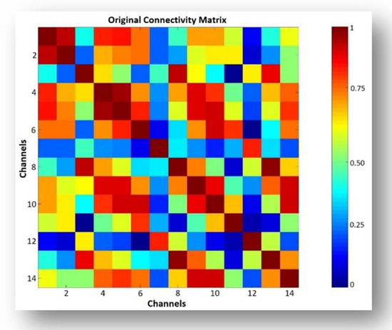 The Effect of Music Listening on EEG Functional Connectivity of Brain ...