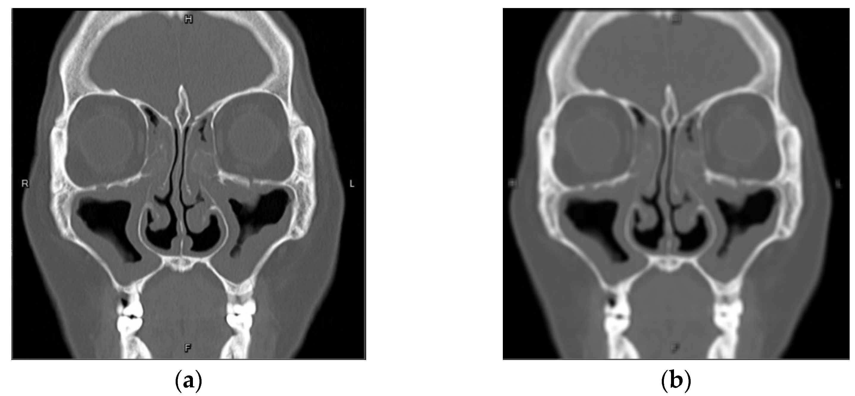 Mathematics 10 01189 g011a