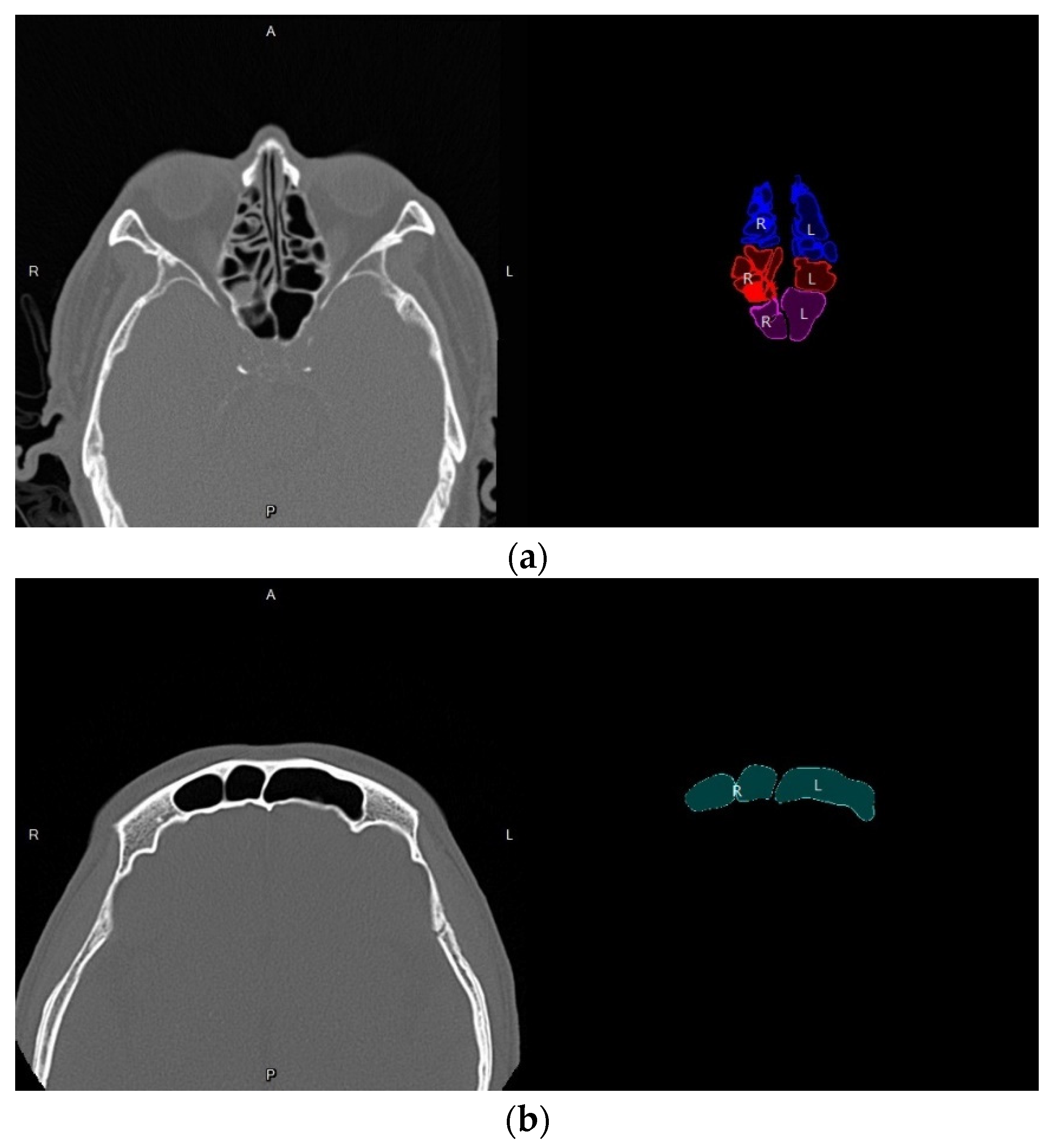 Mathematics 10 01189 g022a