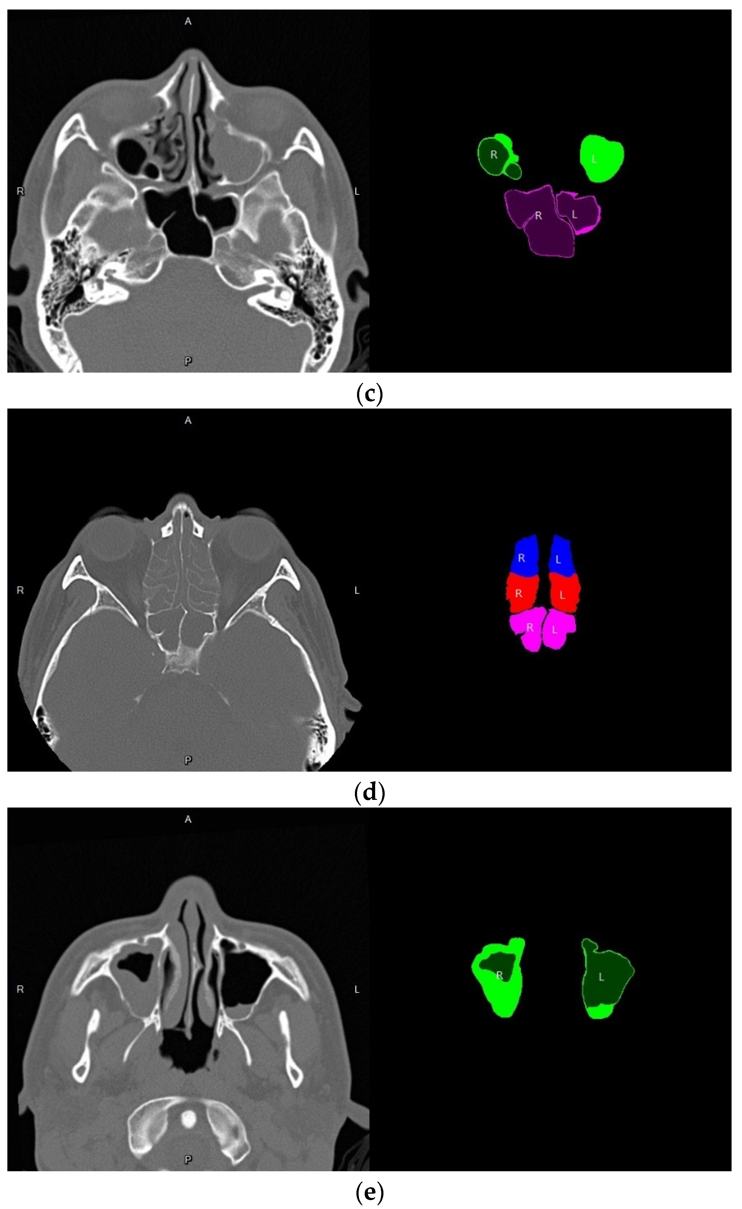 Mathematics 10 01189 g022b