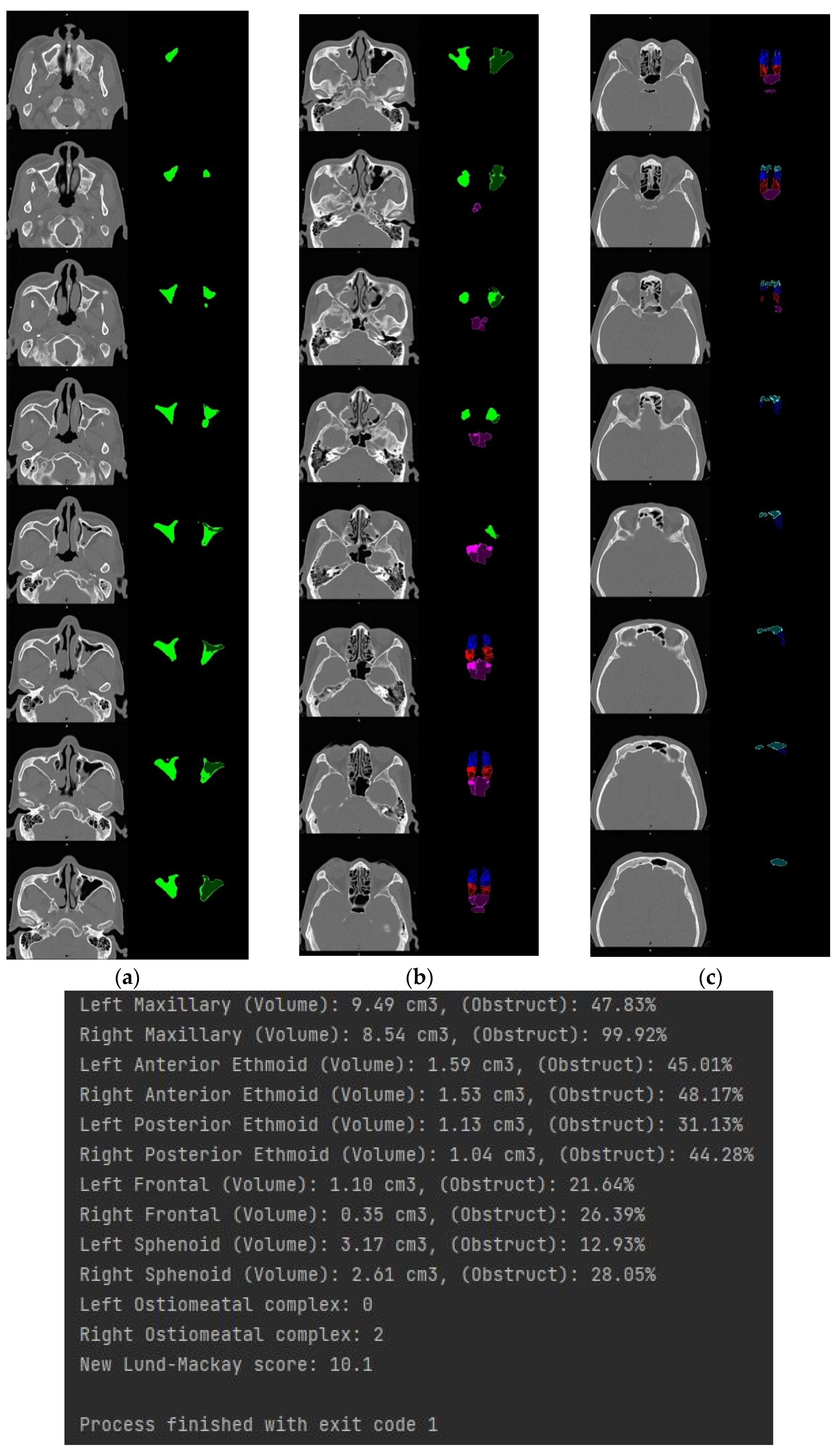 Mathematics 10 01189 g023