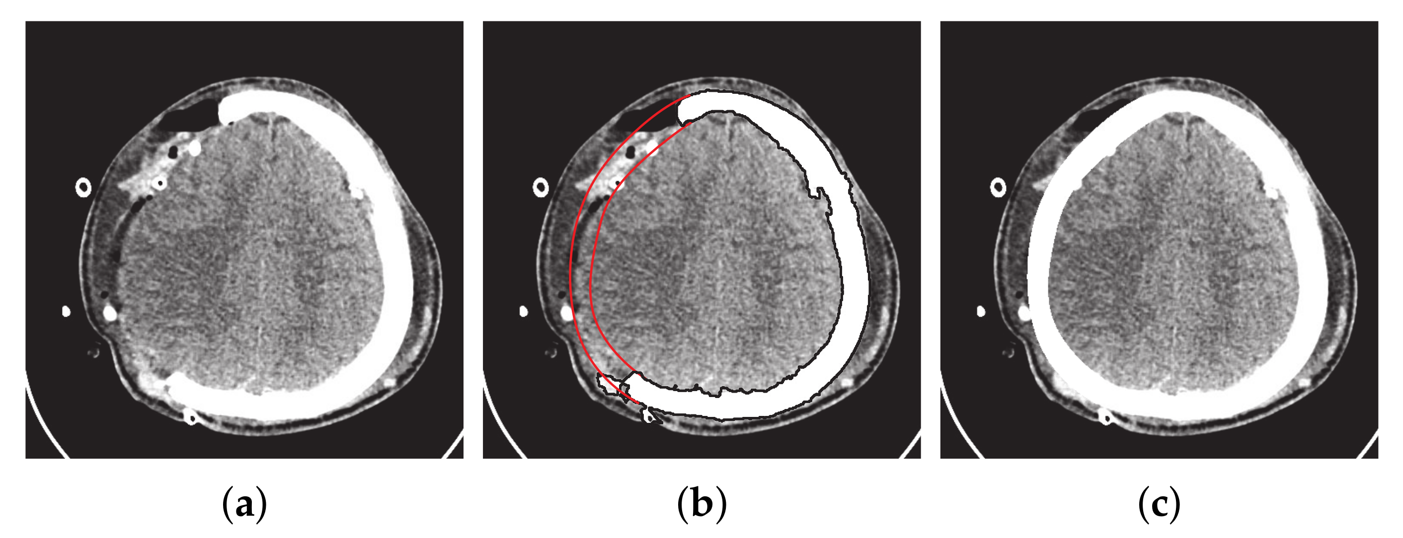 Mathematics 10 01269 g009 Mathematics 10 01269 g009