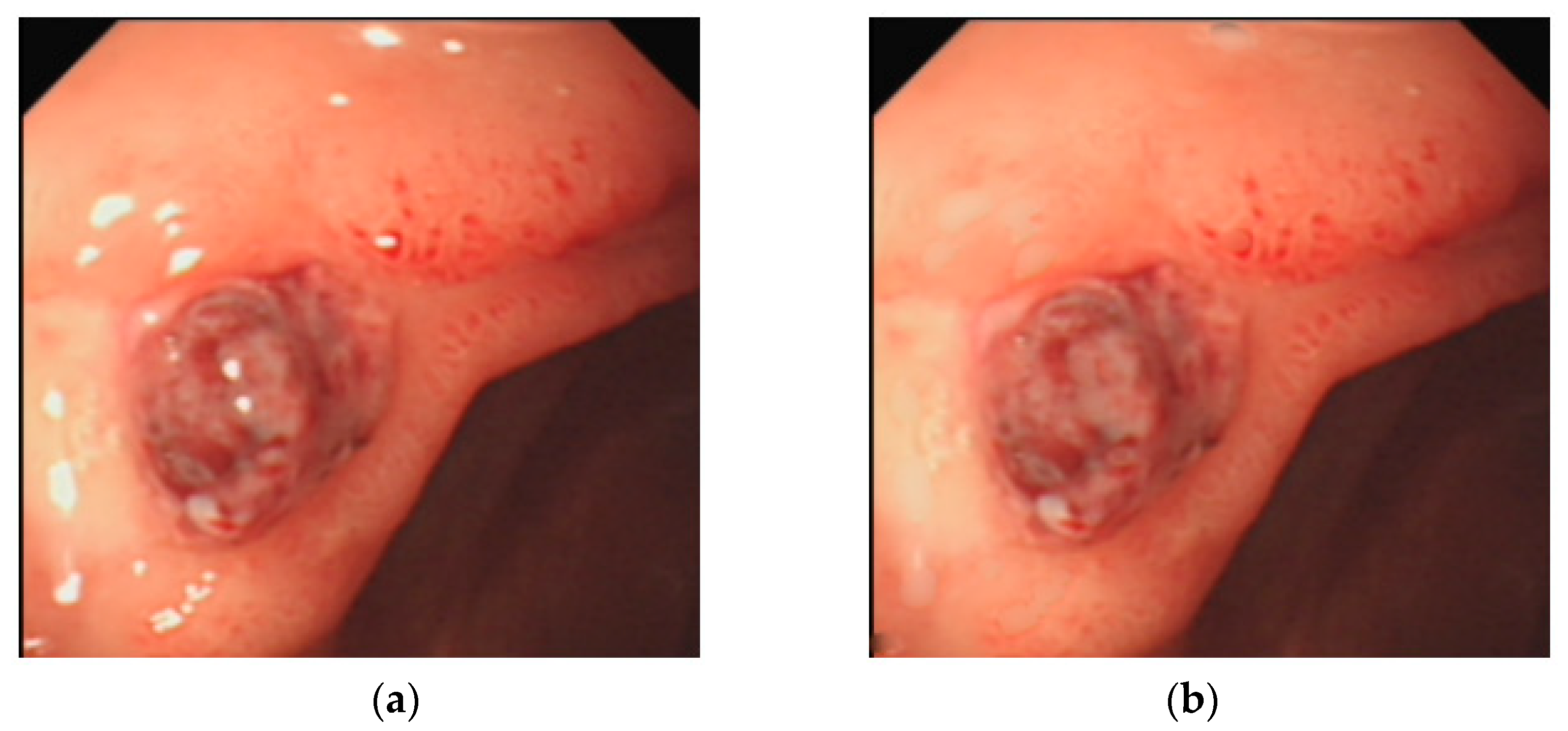 Mathematics 10 01423 g006