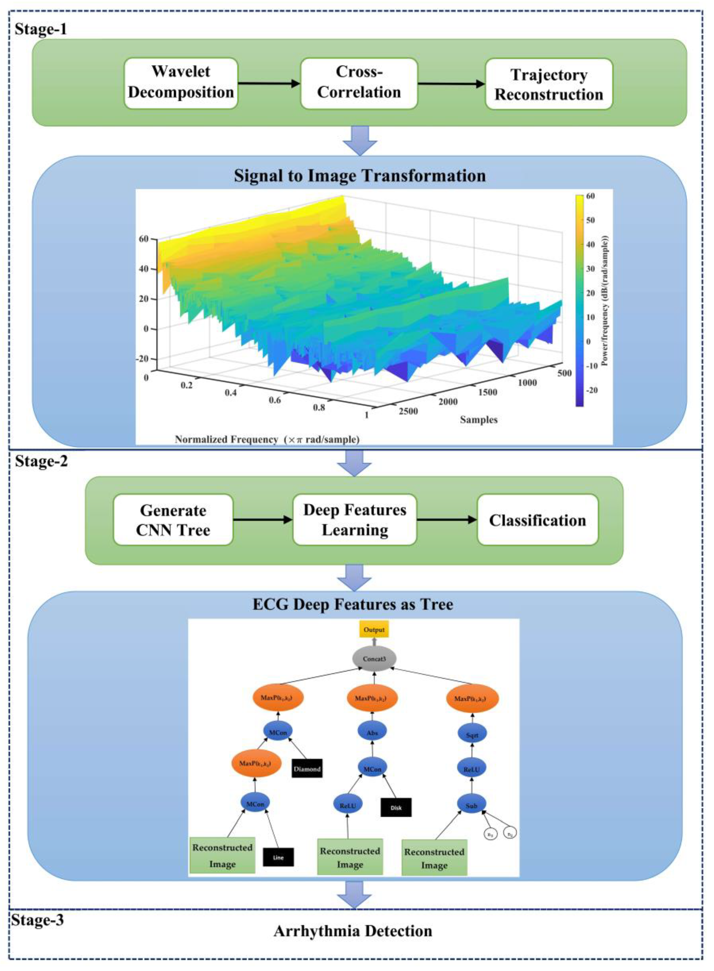 Mathematics Free Full Text A New 12 Lead Ecg Signals Fusion Method Using Evolutionary Cnn Trees For Arrhythmia Detection