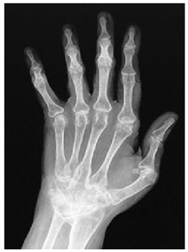 Mathematics 10 02421 i006