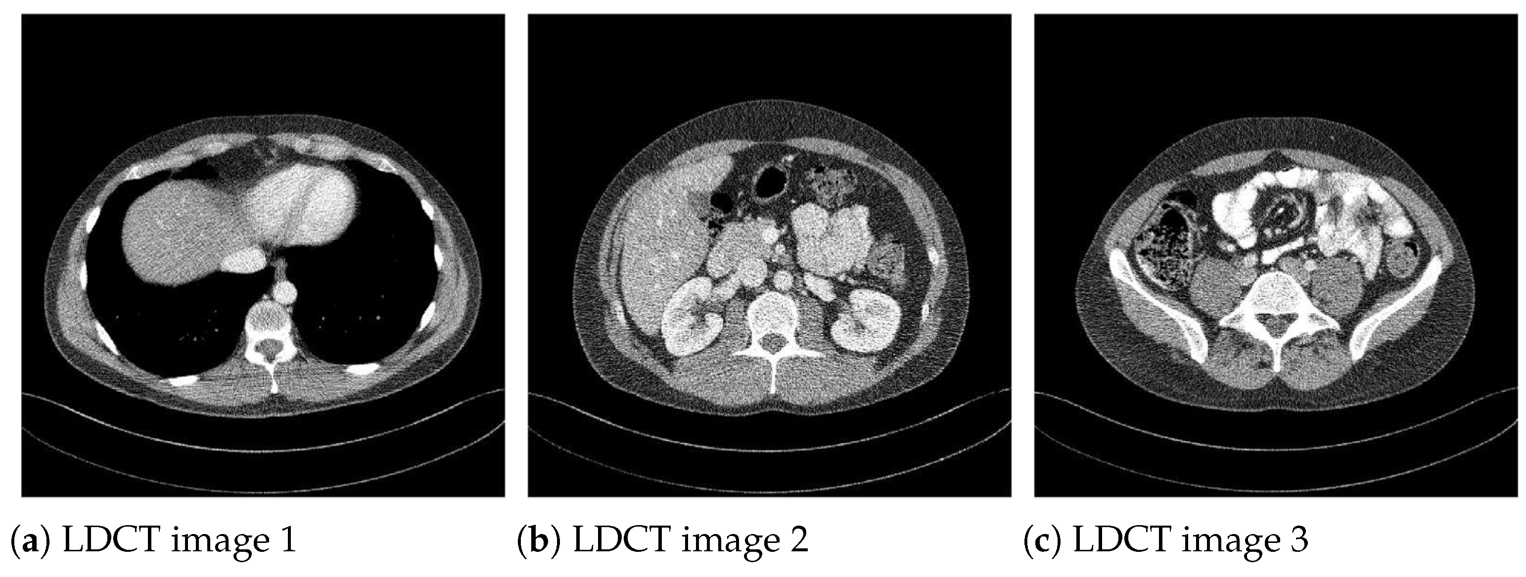 Mathematics Free FullText Fast Method Based on Fuzzy Logic for