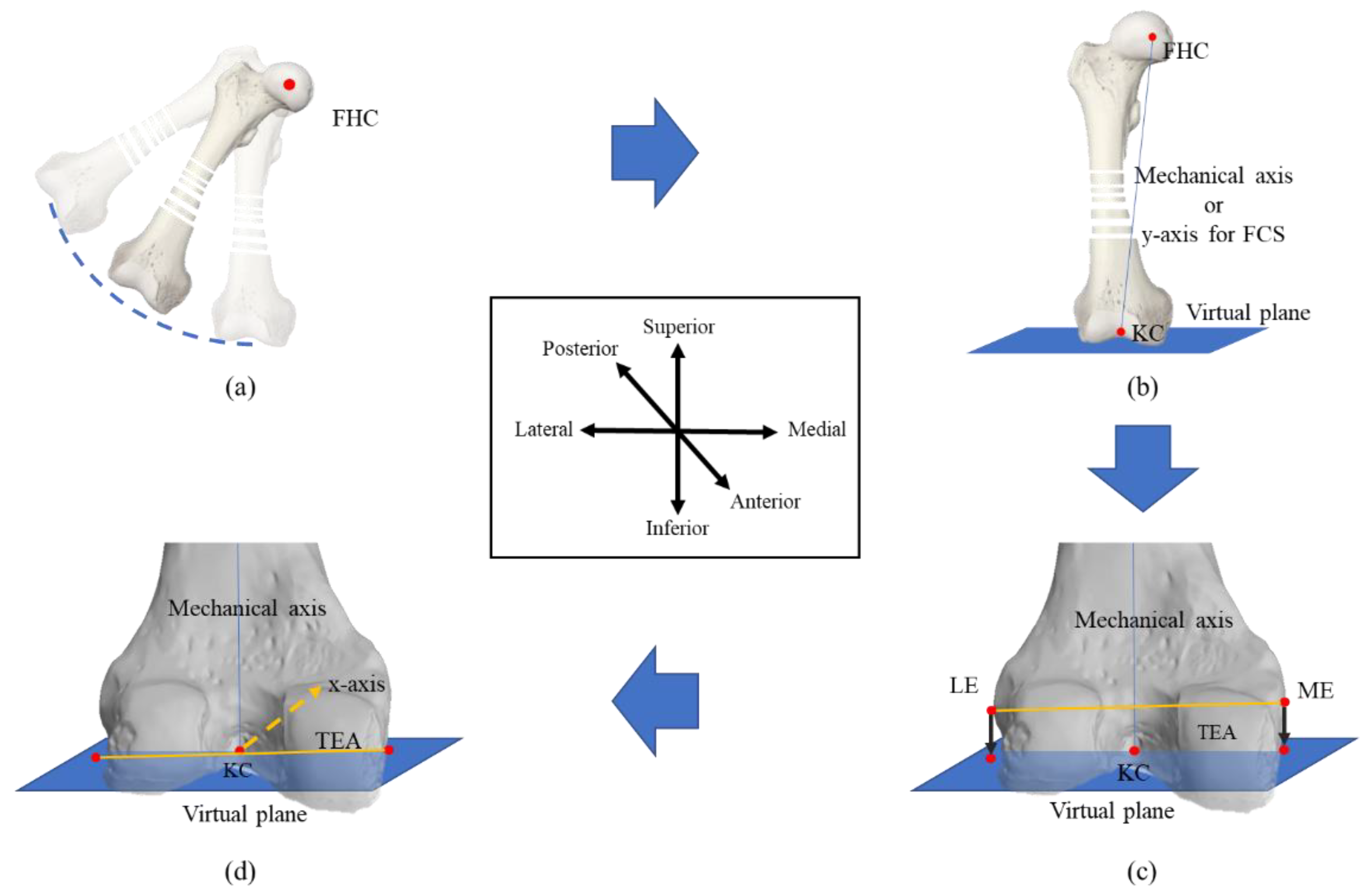 Modified Whiteside's Line-Based Transepicondylar Axis for