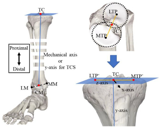 整形外科 専門医への minimal requirements Ultrasound-Guided Lumbar Facet Nerve Block and Intra
