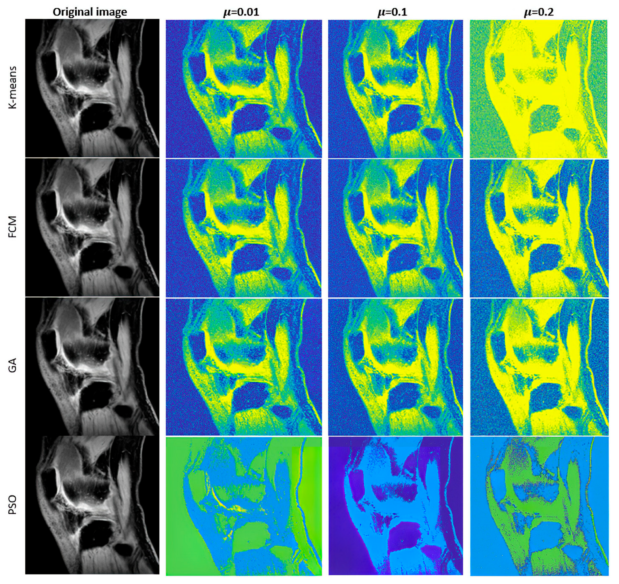 Mathematics 11 01027 g004