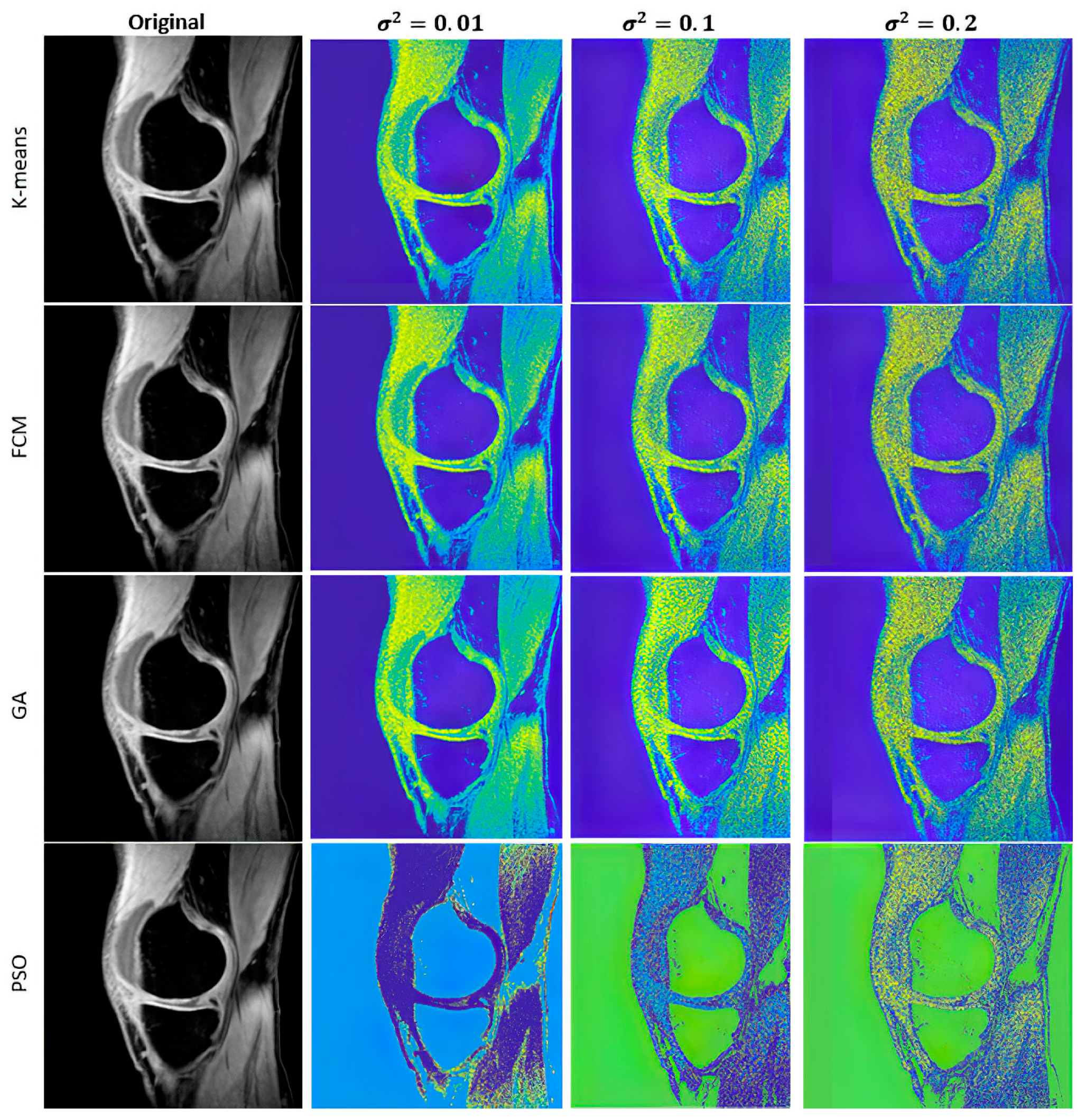 Mathematics 11 01027 g005