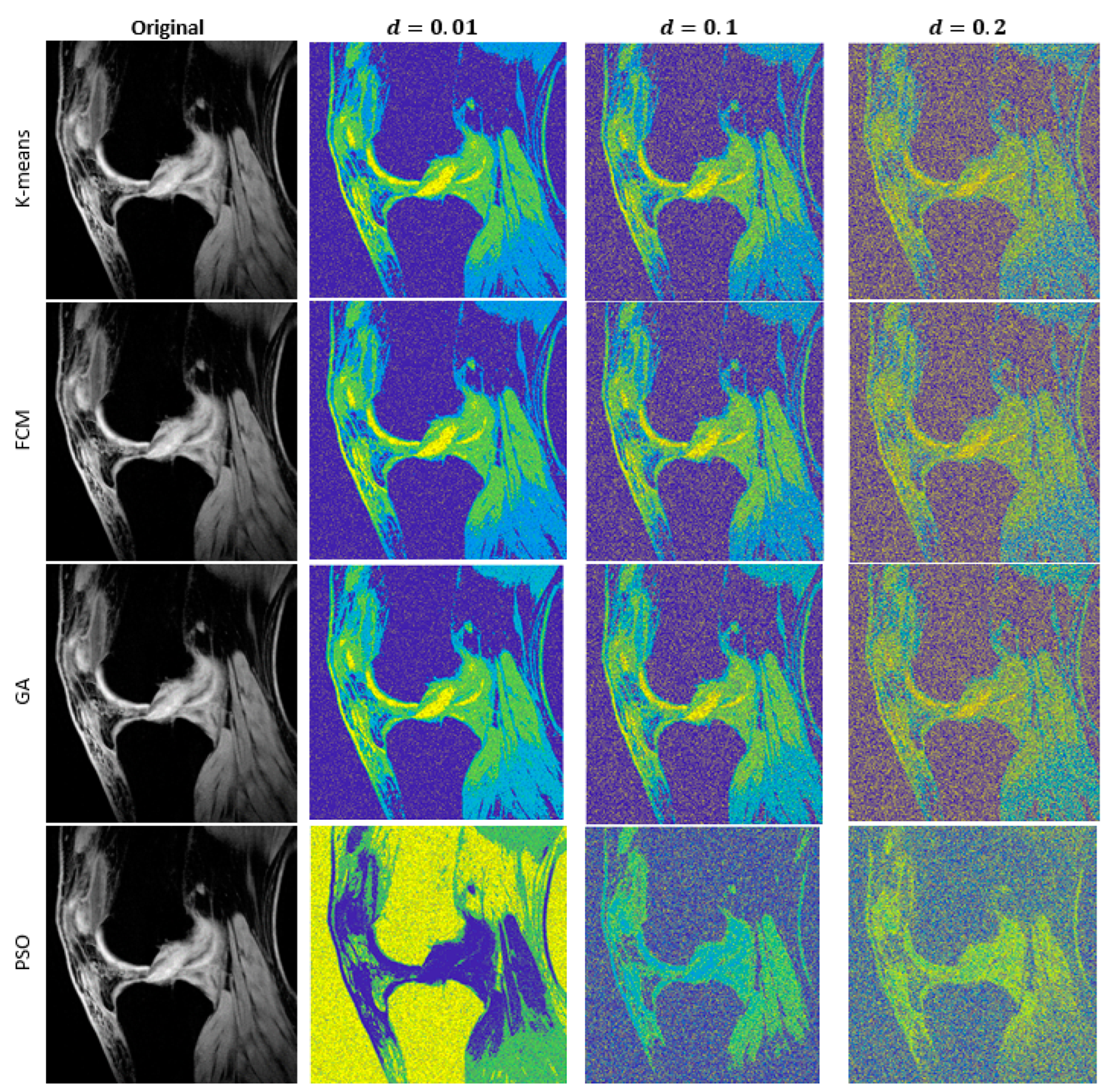 Mathematics 11 01027 g006