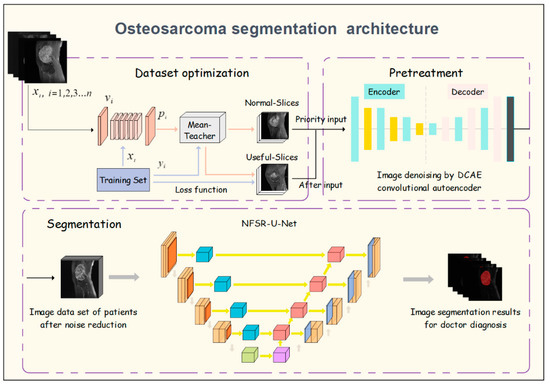 A Tumor MRI Image Segmentation Framework Based on Class-Correlation ...