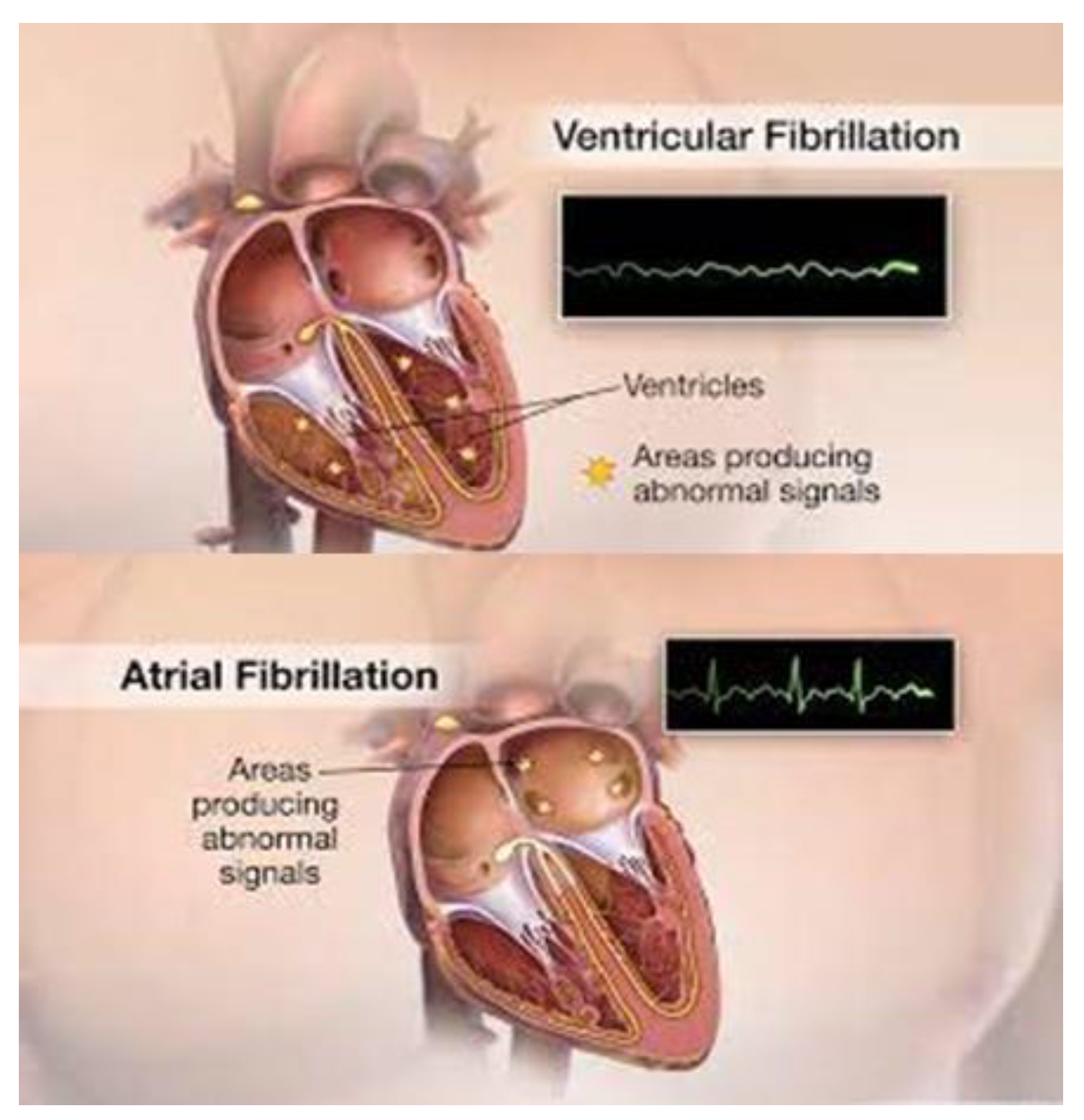 Mathematics 11 01781 g004