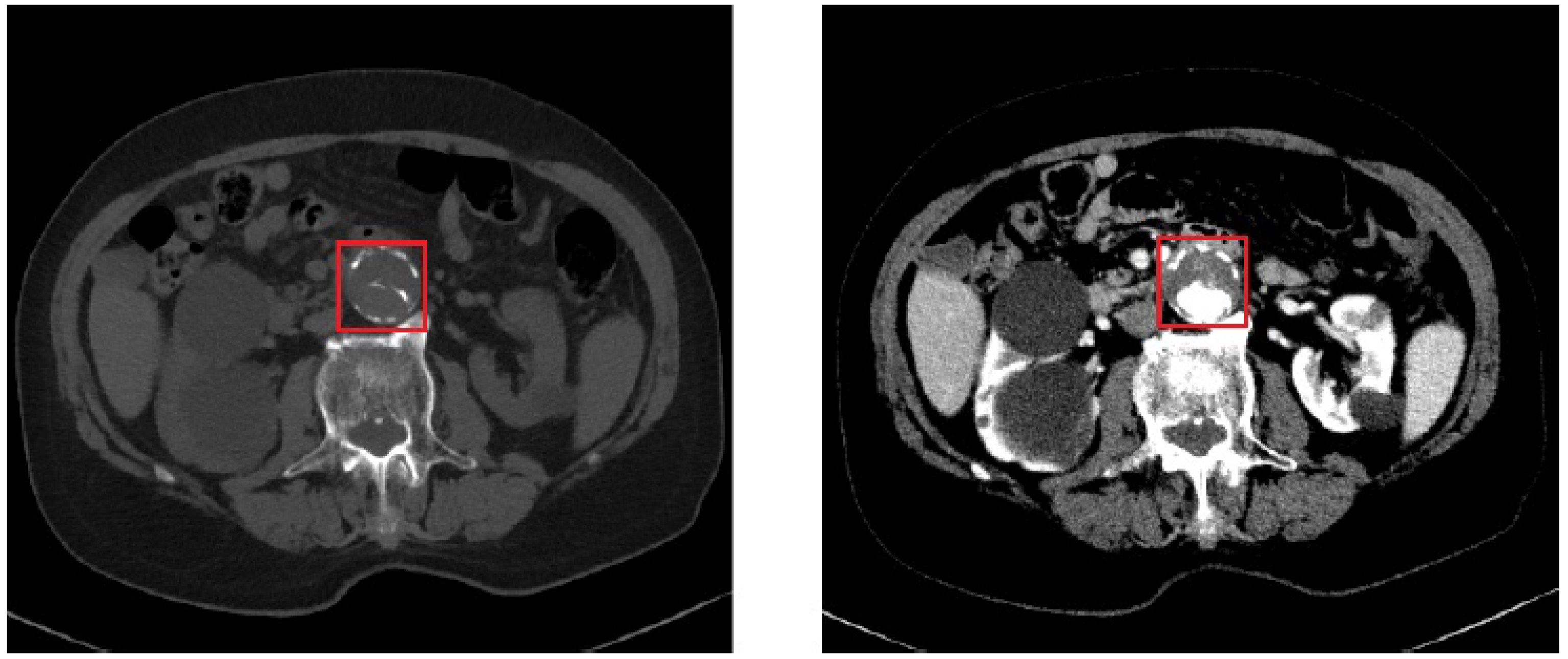 Mathematics 11 01831 g003