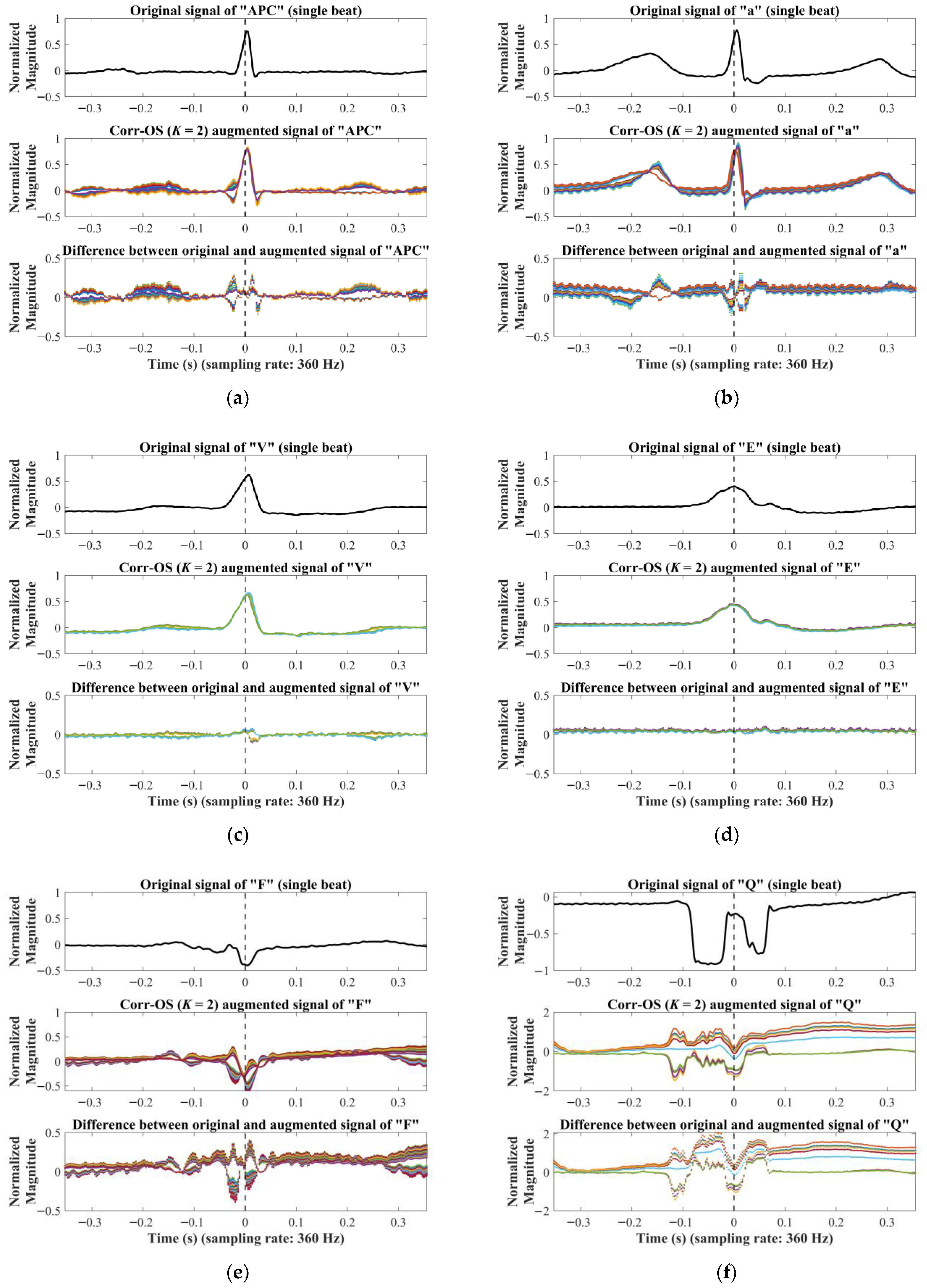 Mathematics 11 01833 g0a6 Mathematics 11 01833 g0a6
