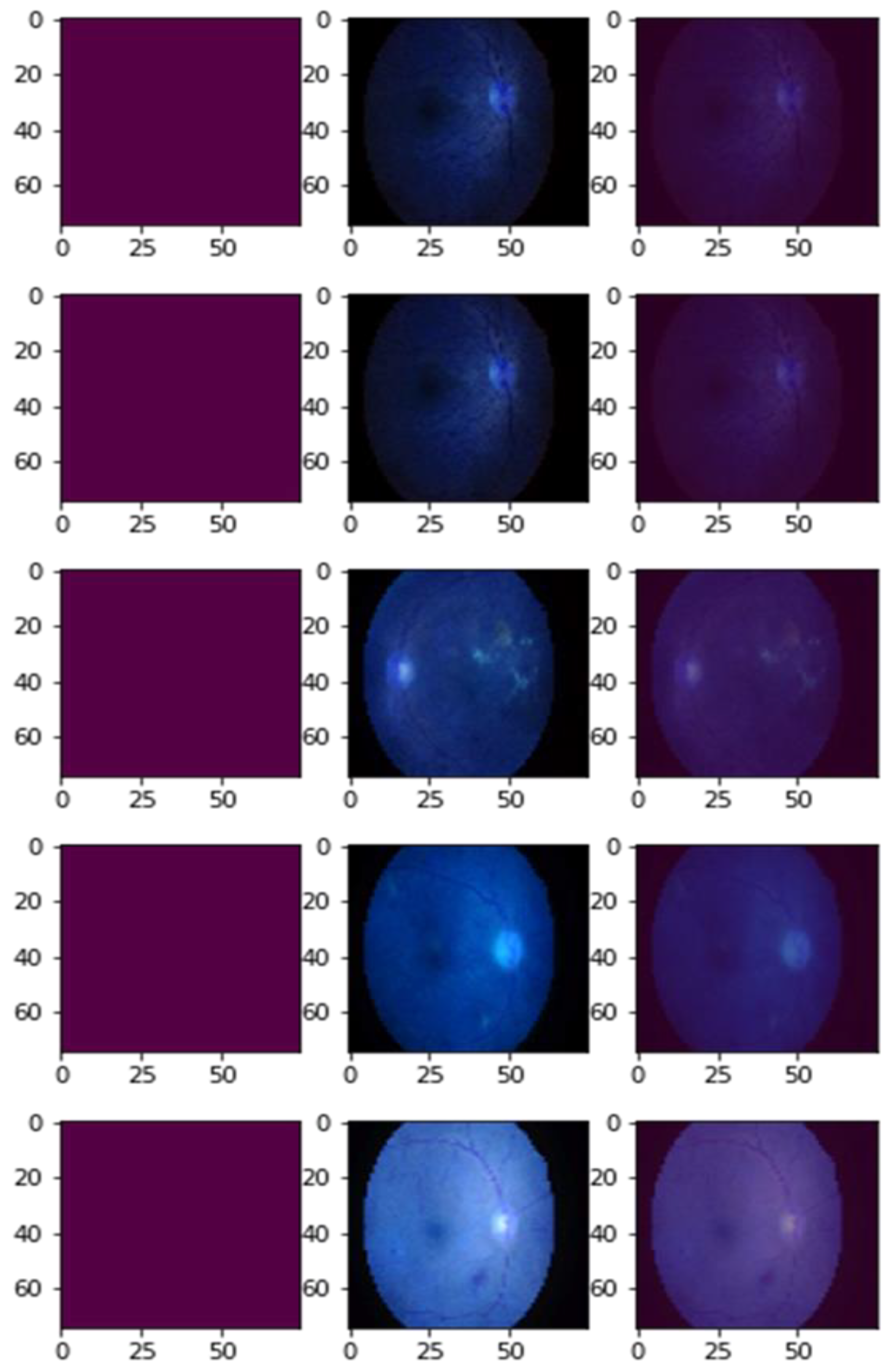 Mathematics 11 02008 g005