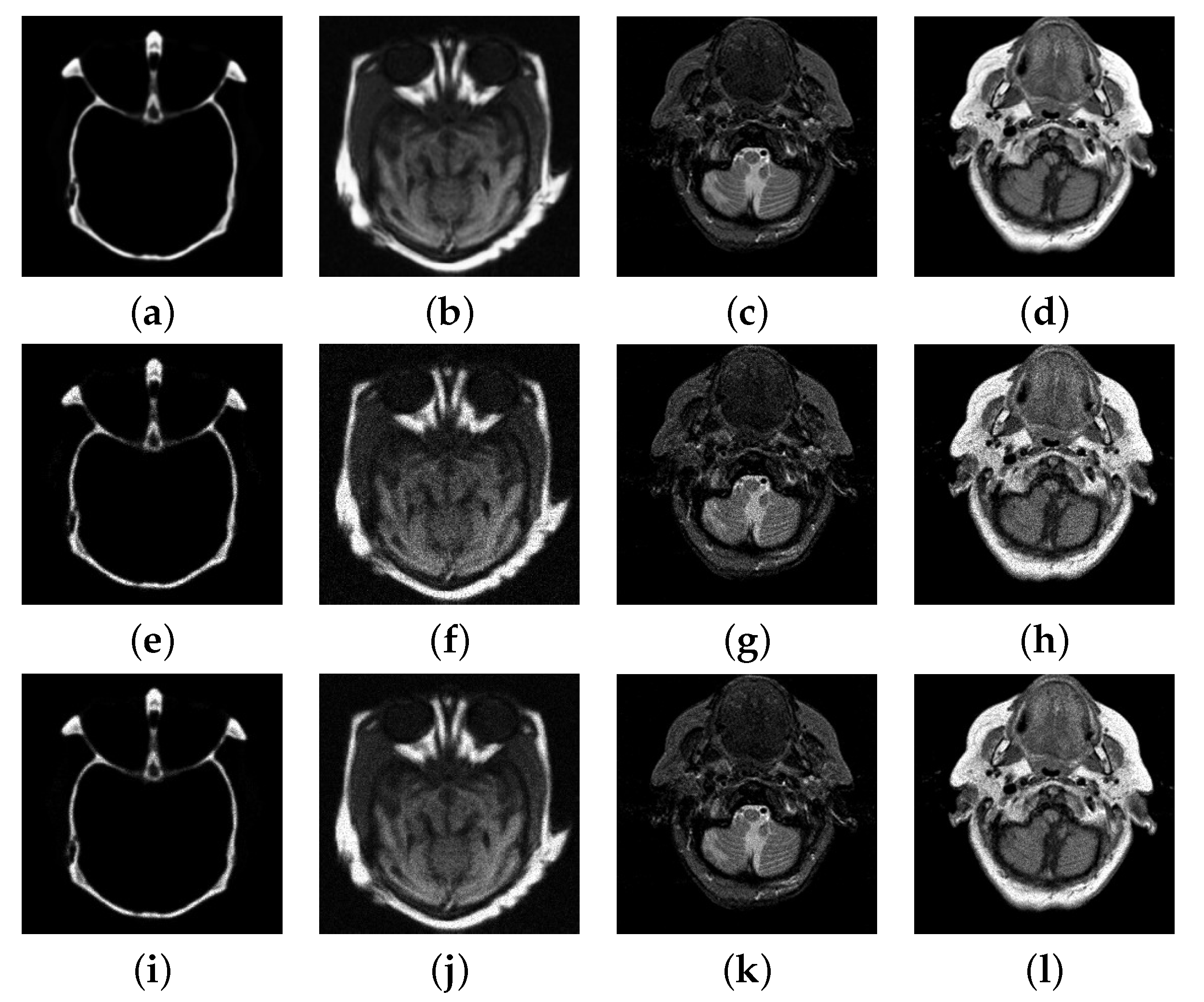 Mathematics 11 02260 g005