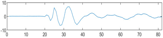 Filtering of Audio Signals Using Discrete Wavelet Transforms