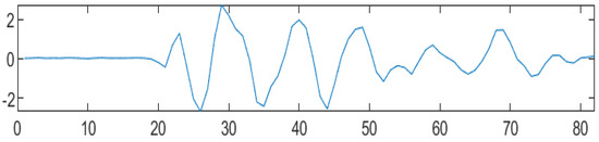 Filtering of Audio Signals Using Discrete Wavelet Transforms