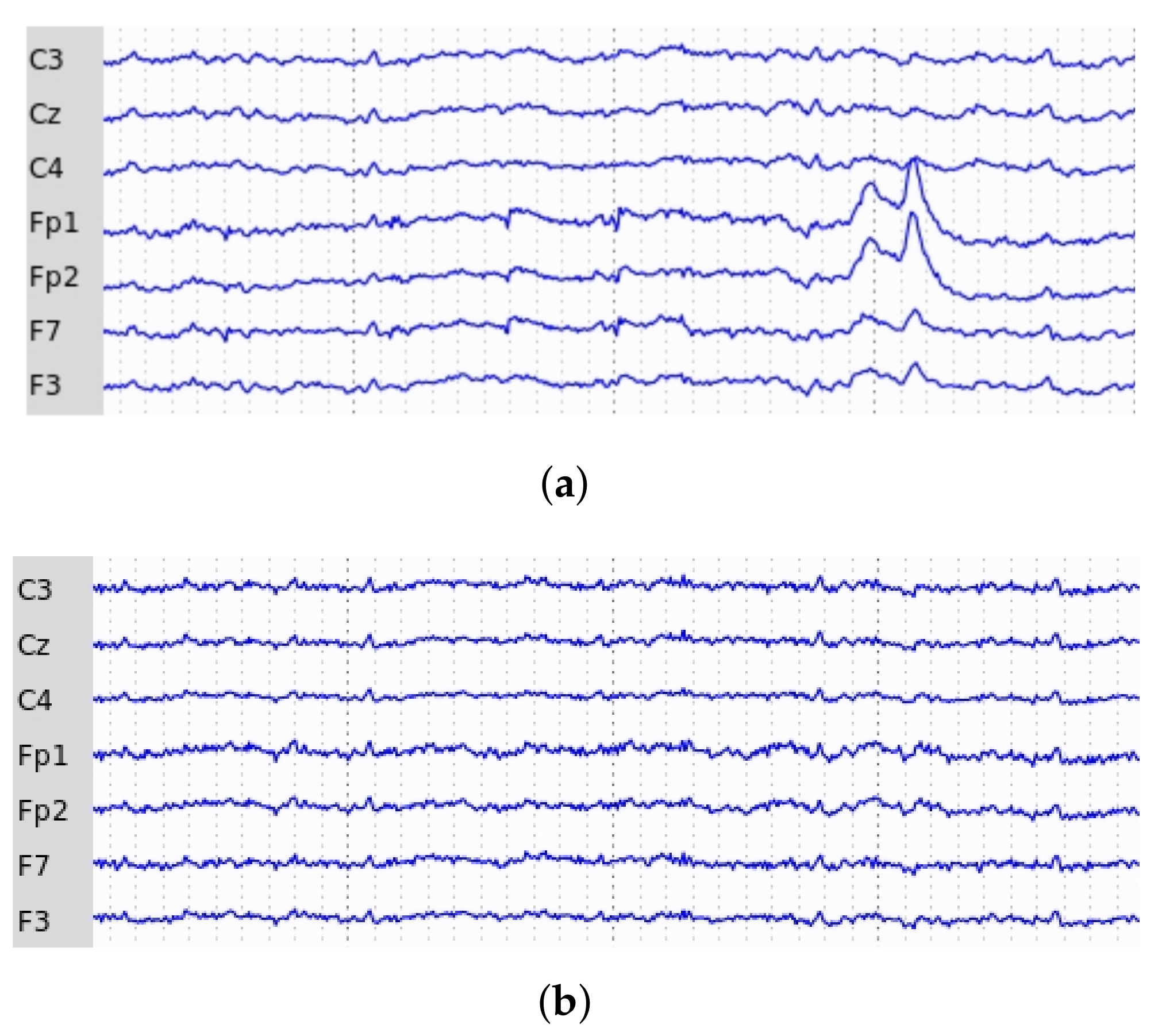 Mathematics 11 04409 g004