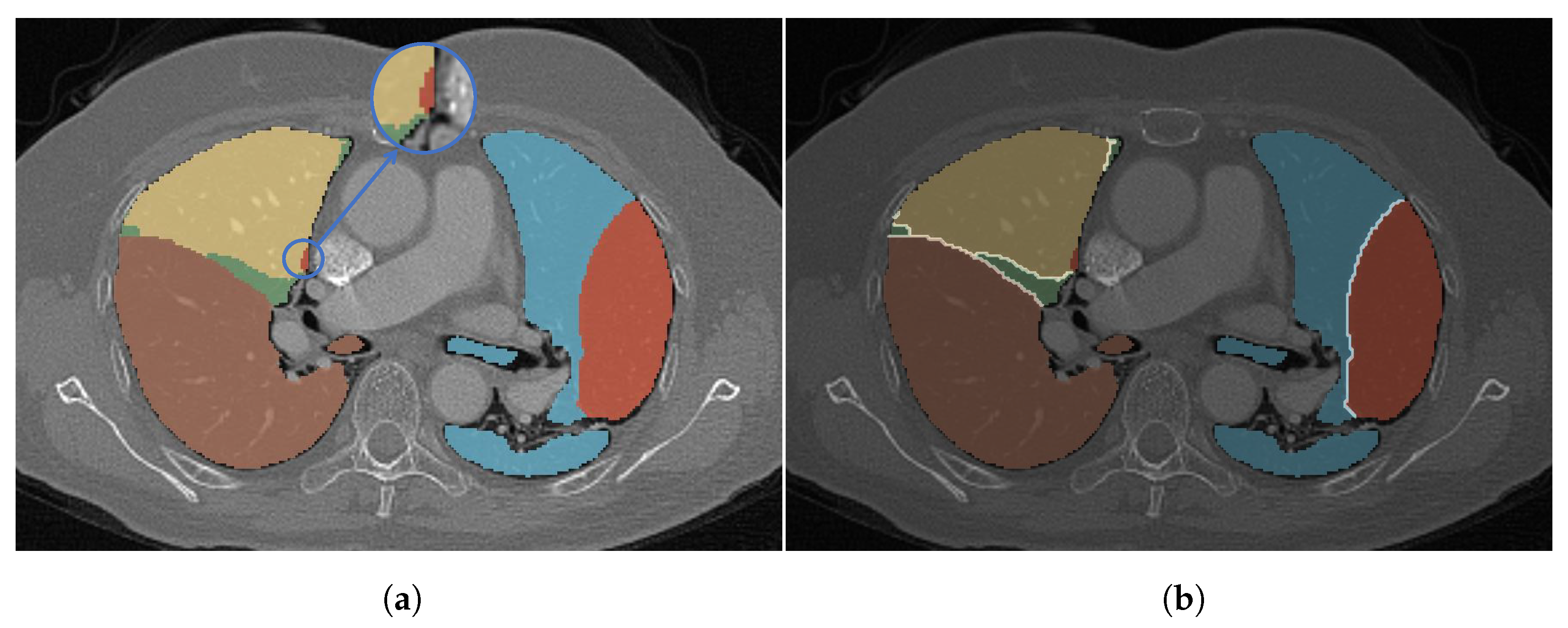 Mathematics 11 04675 g003
