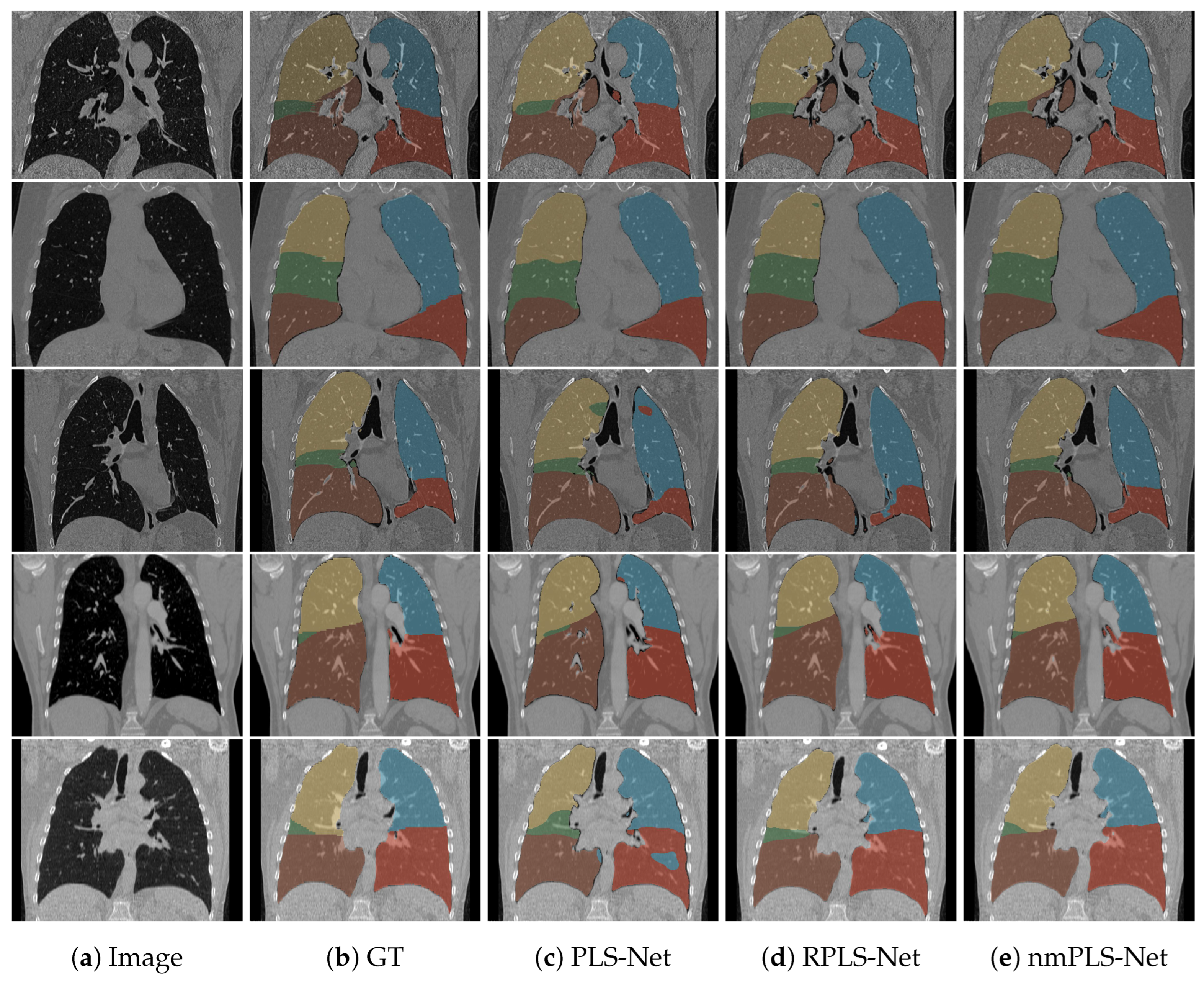 Mathematics 11 04675 g004