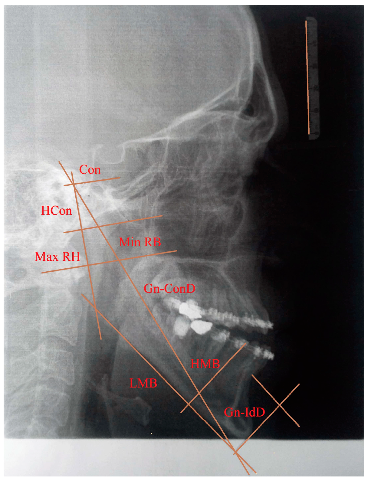Mathematics 12 01577 g001