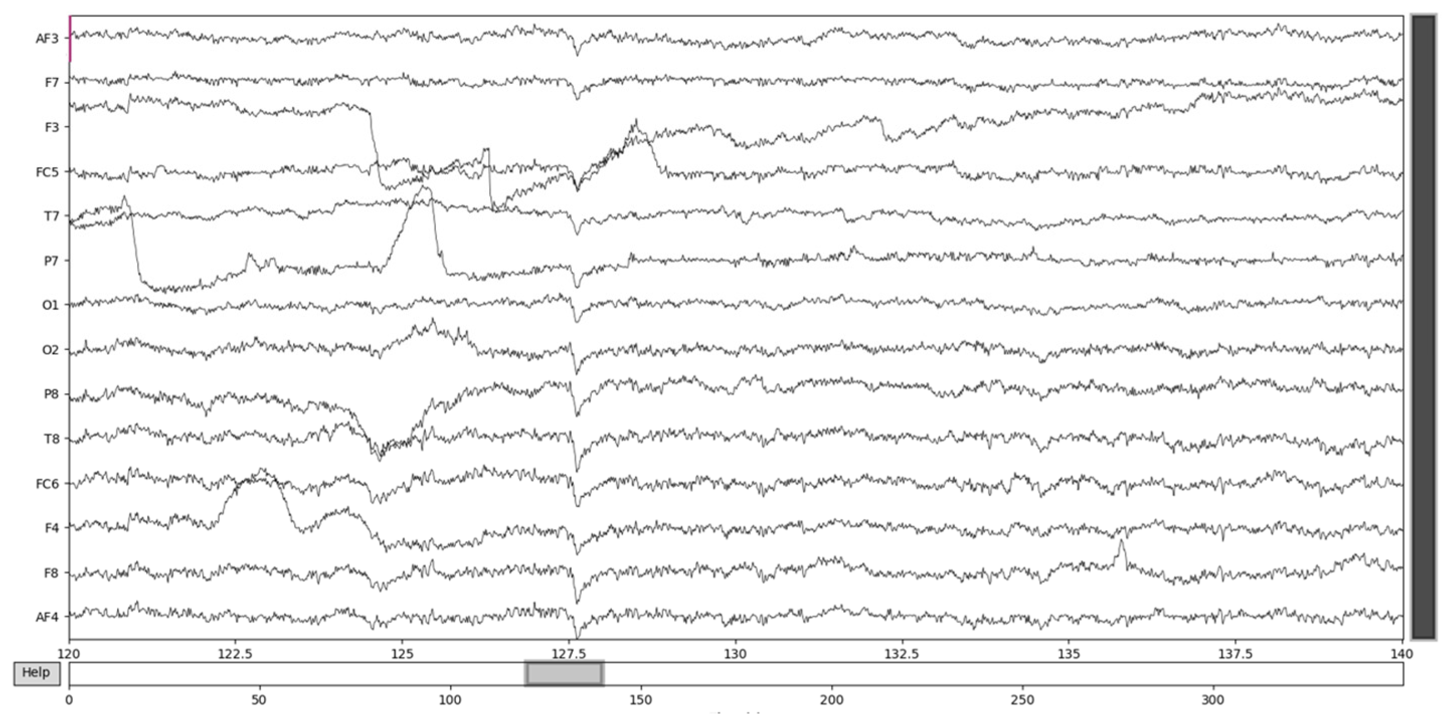 Mathematics 13 00254 g005