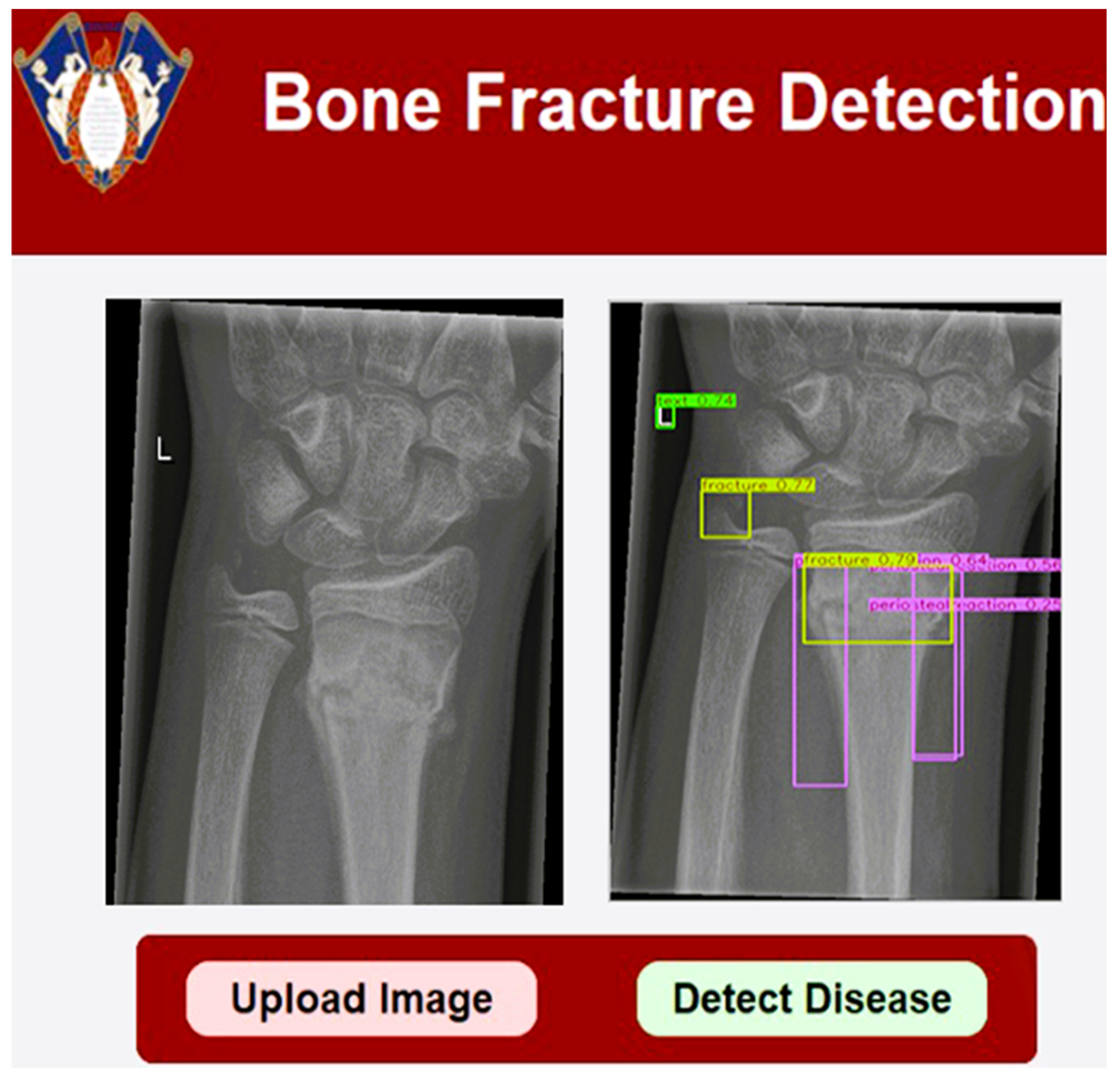 Mathematics 13 01419 g014