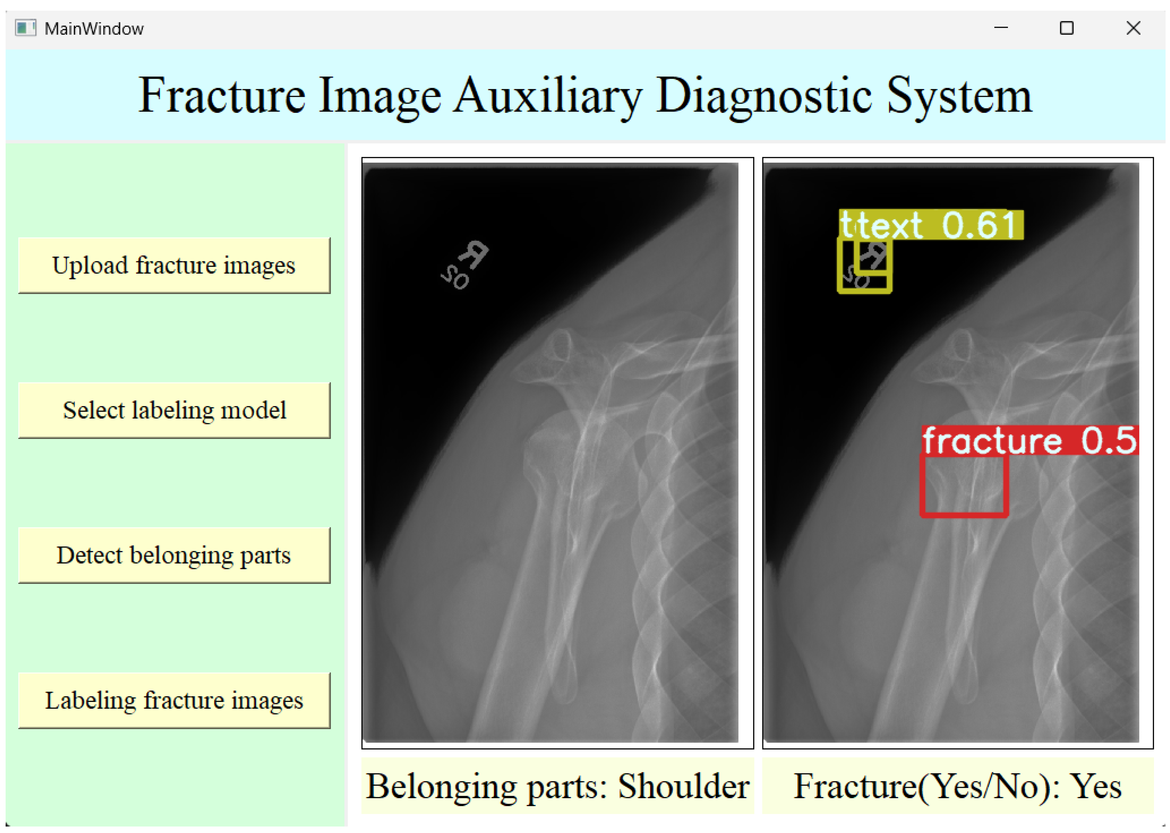 Mathematics 13 01858 g005