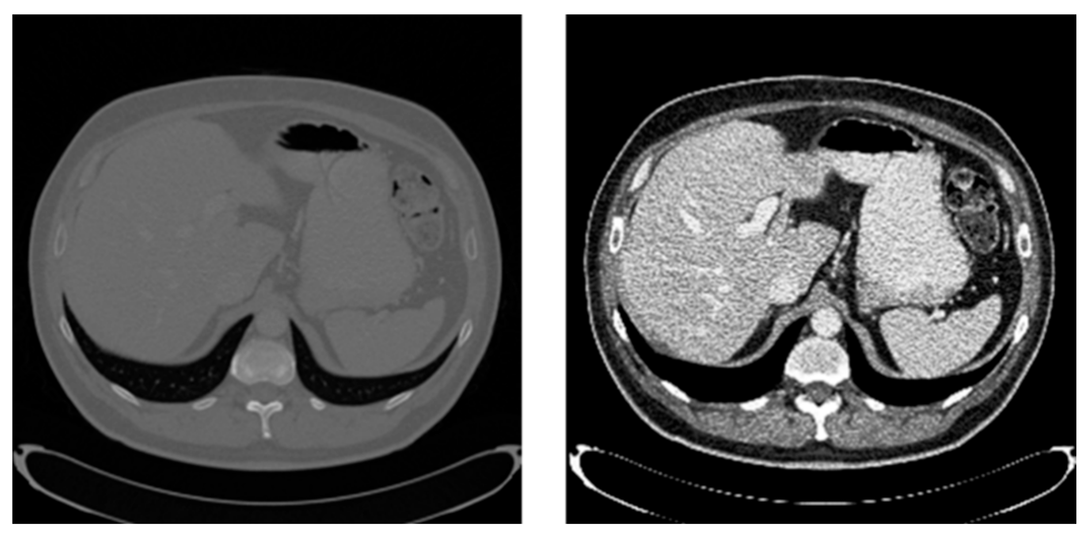 Mathematics 14 00575 g010