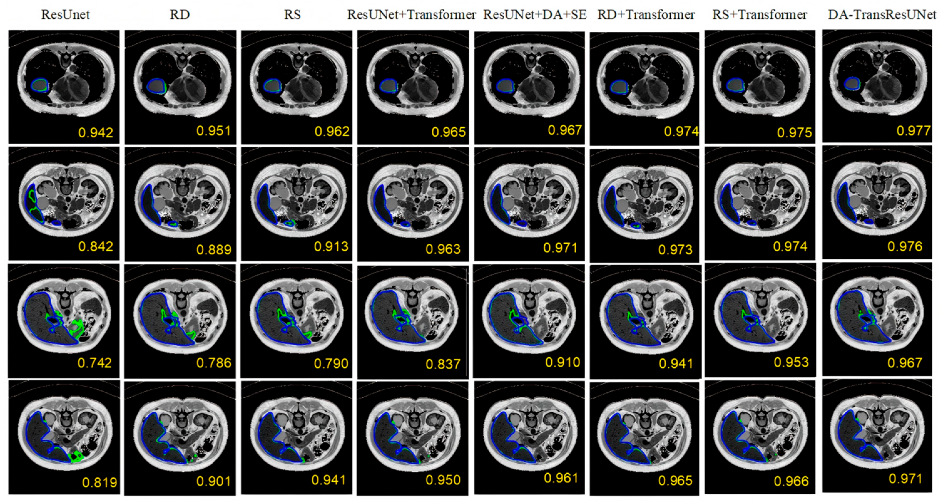 Mathematics 14 00575 g011