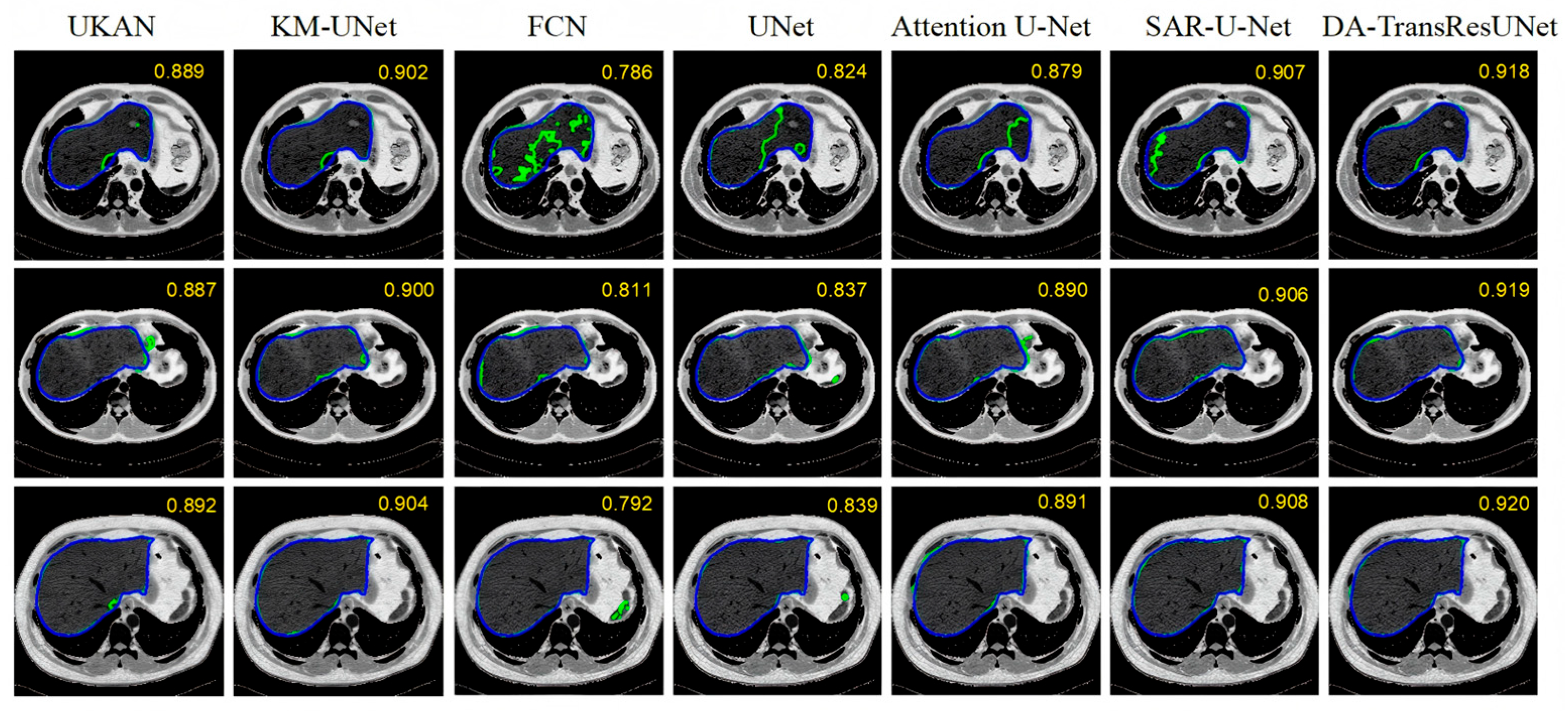 Mathematics 14 00575 g014