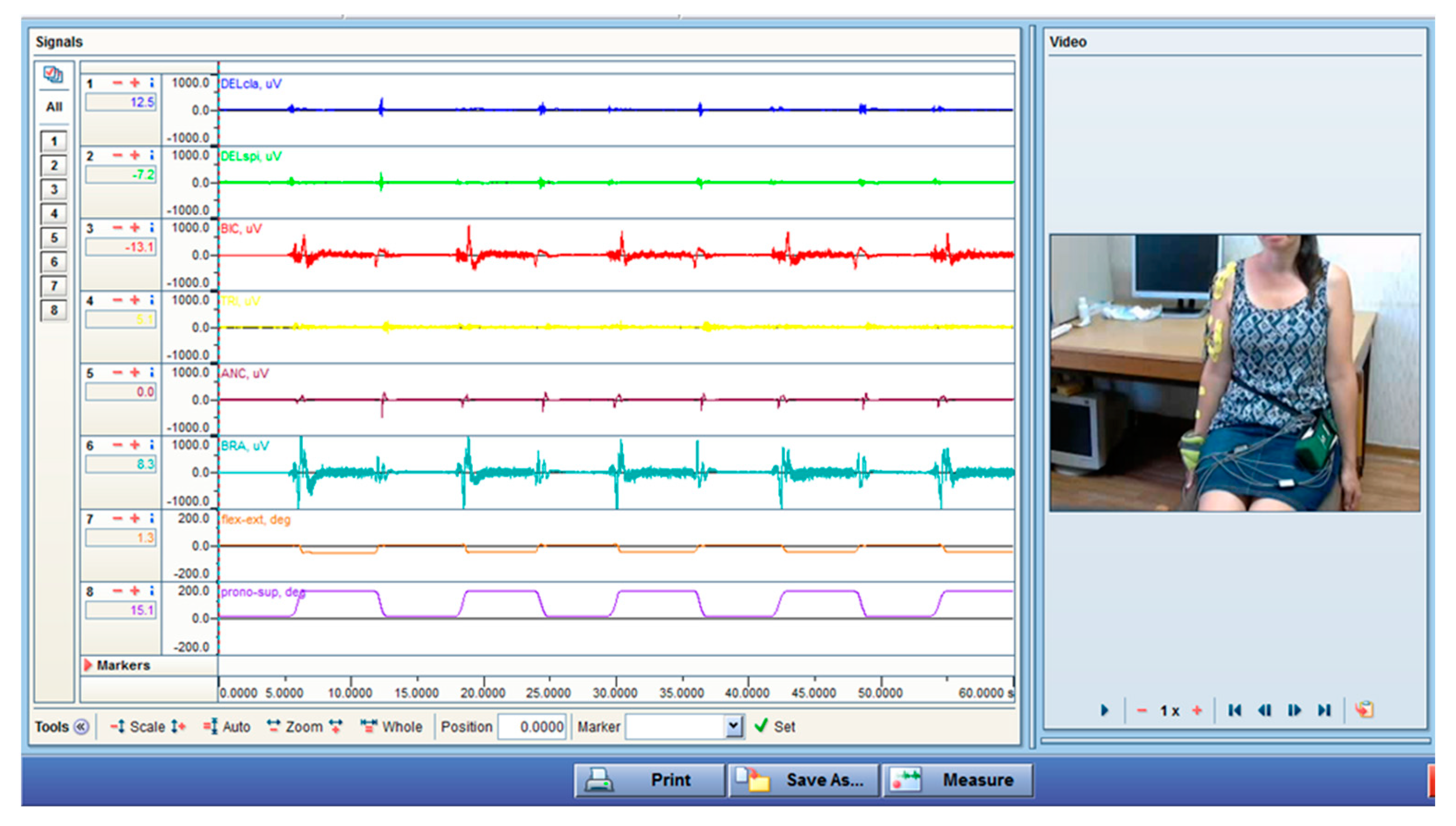 MCA | Free Full-Text | Estimating Surface EMG Activity of Human Upper ...