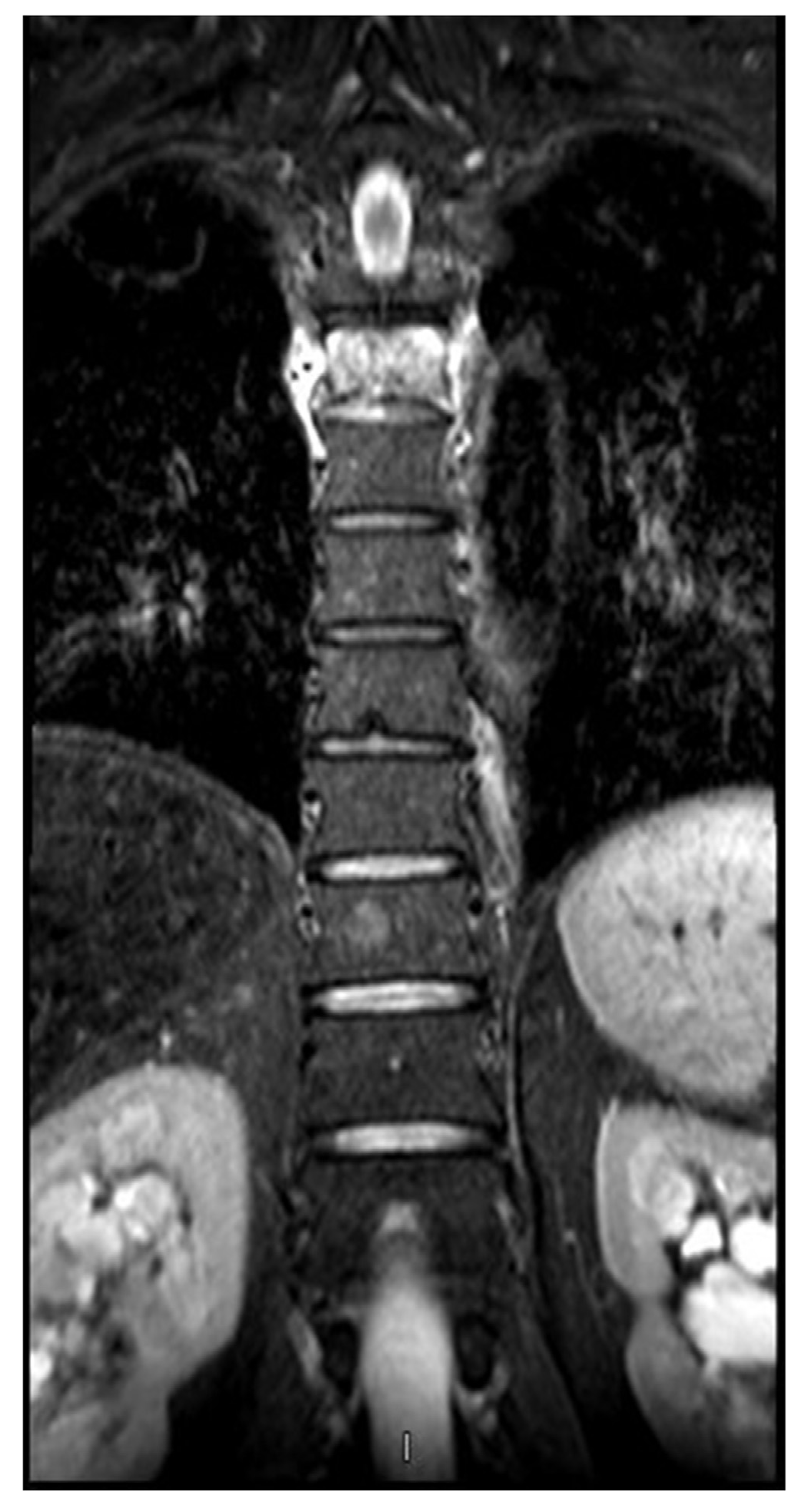 Medicina 53 00131 g002 550