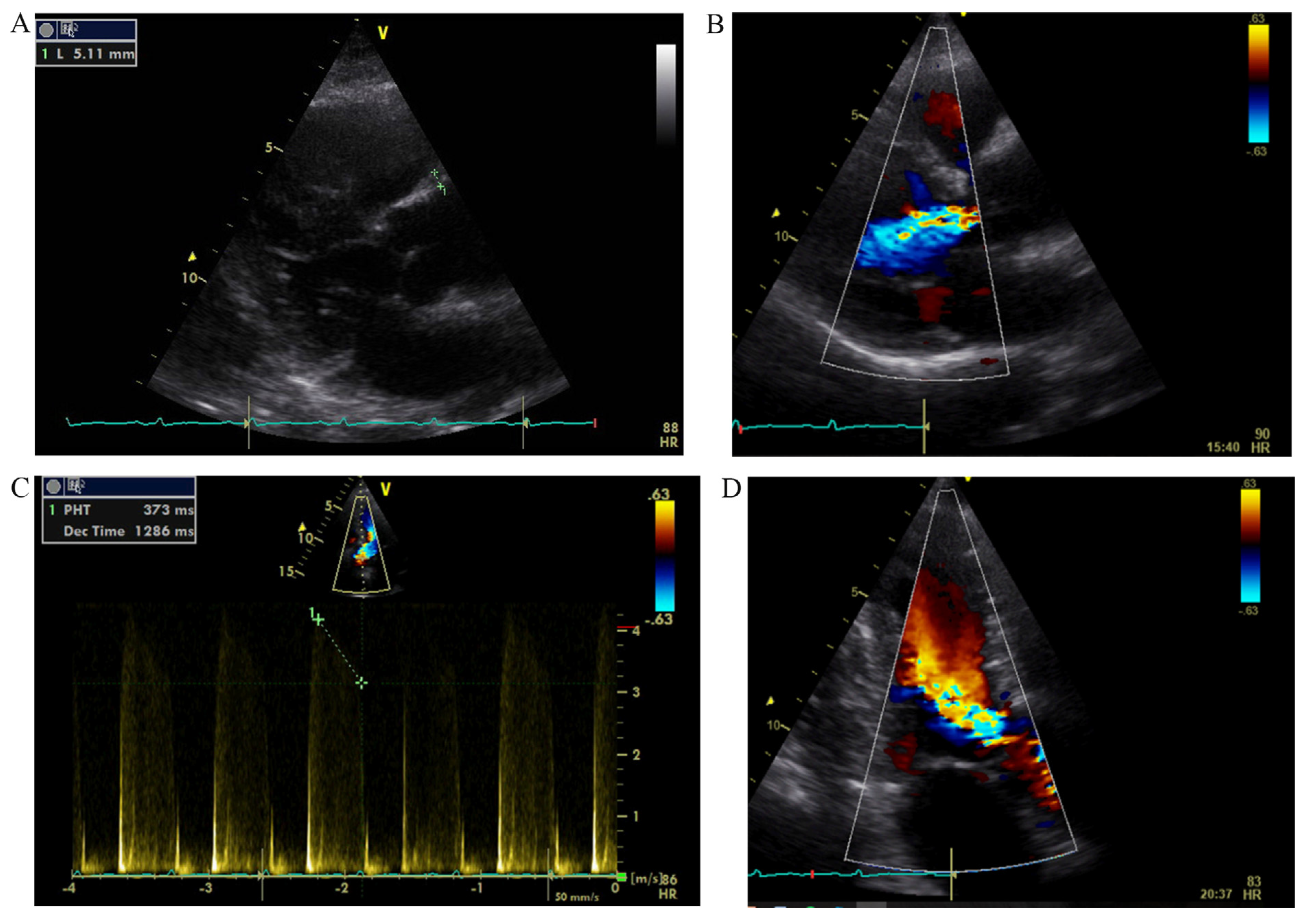 Medicina 53 00211 g002 550