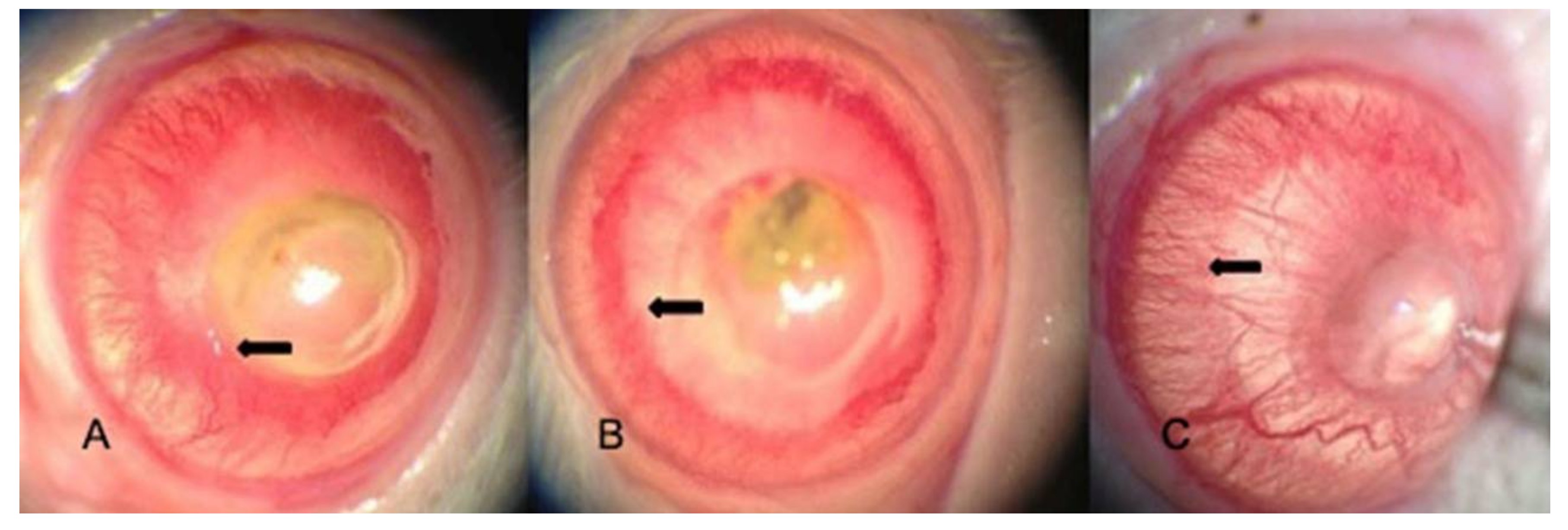 Medicina 54 00016 g002