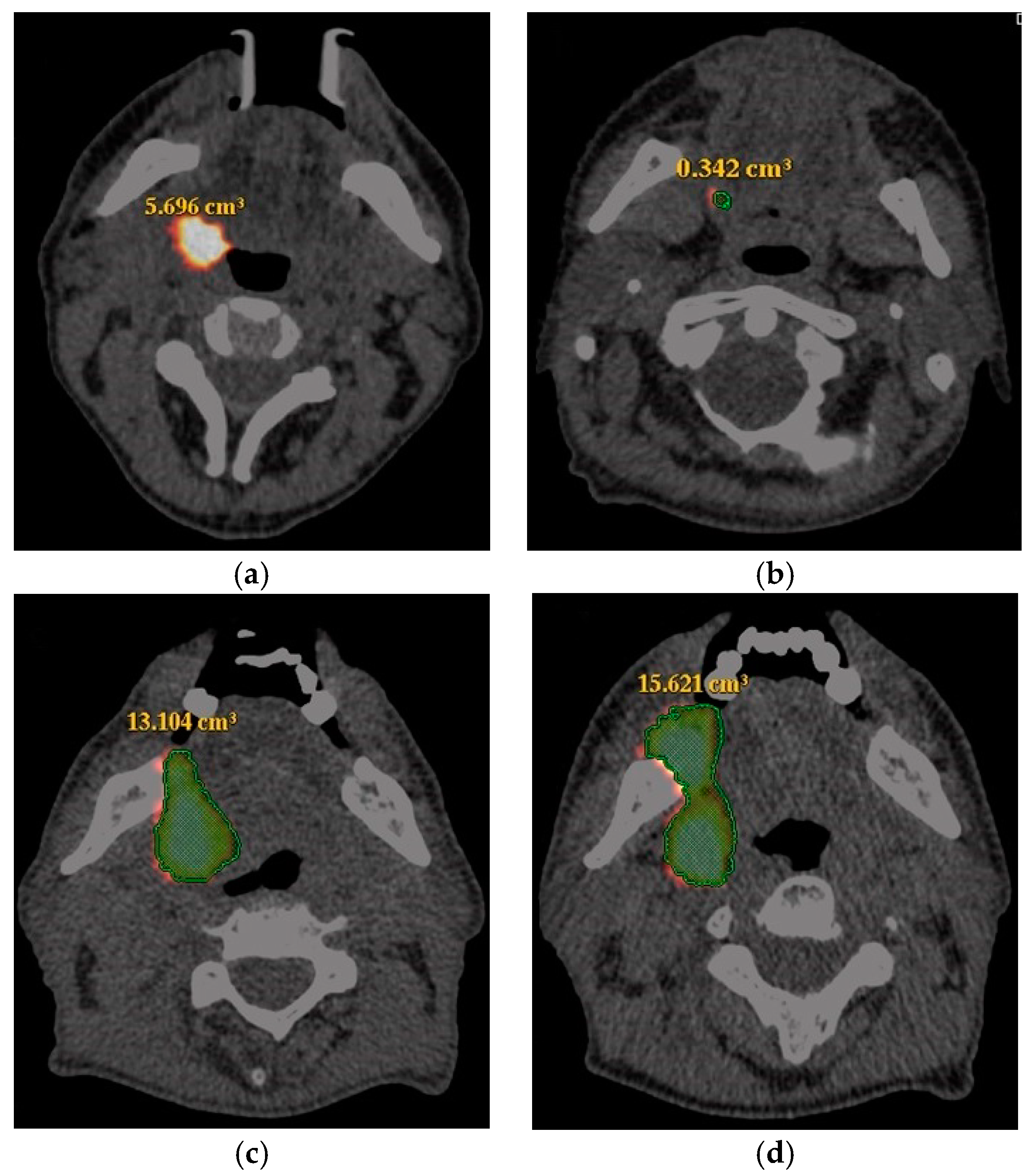 Medicina 54 00031 g001 Medicina 54 00031 g001