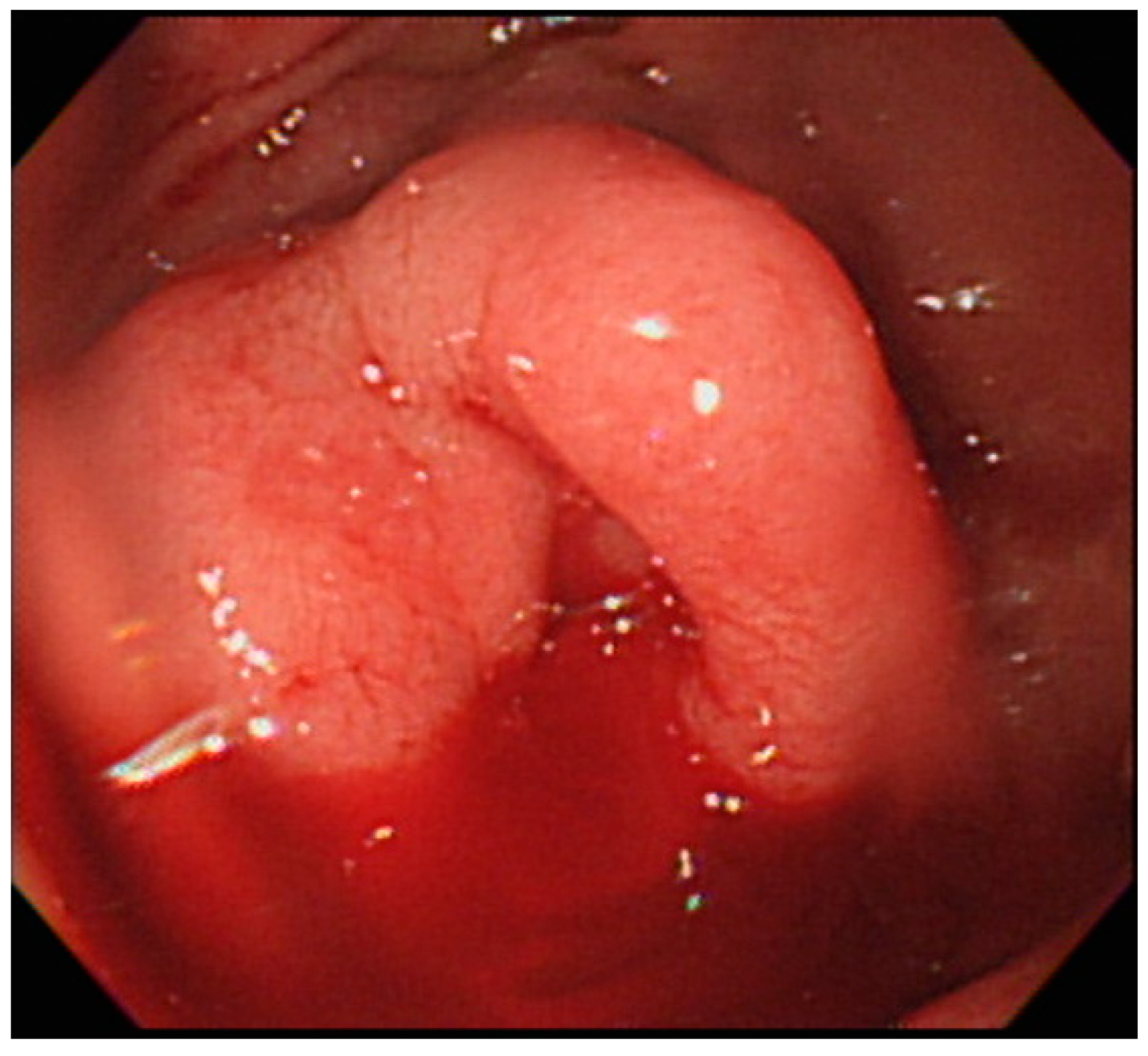 Medicina 54 00068 g001