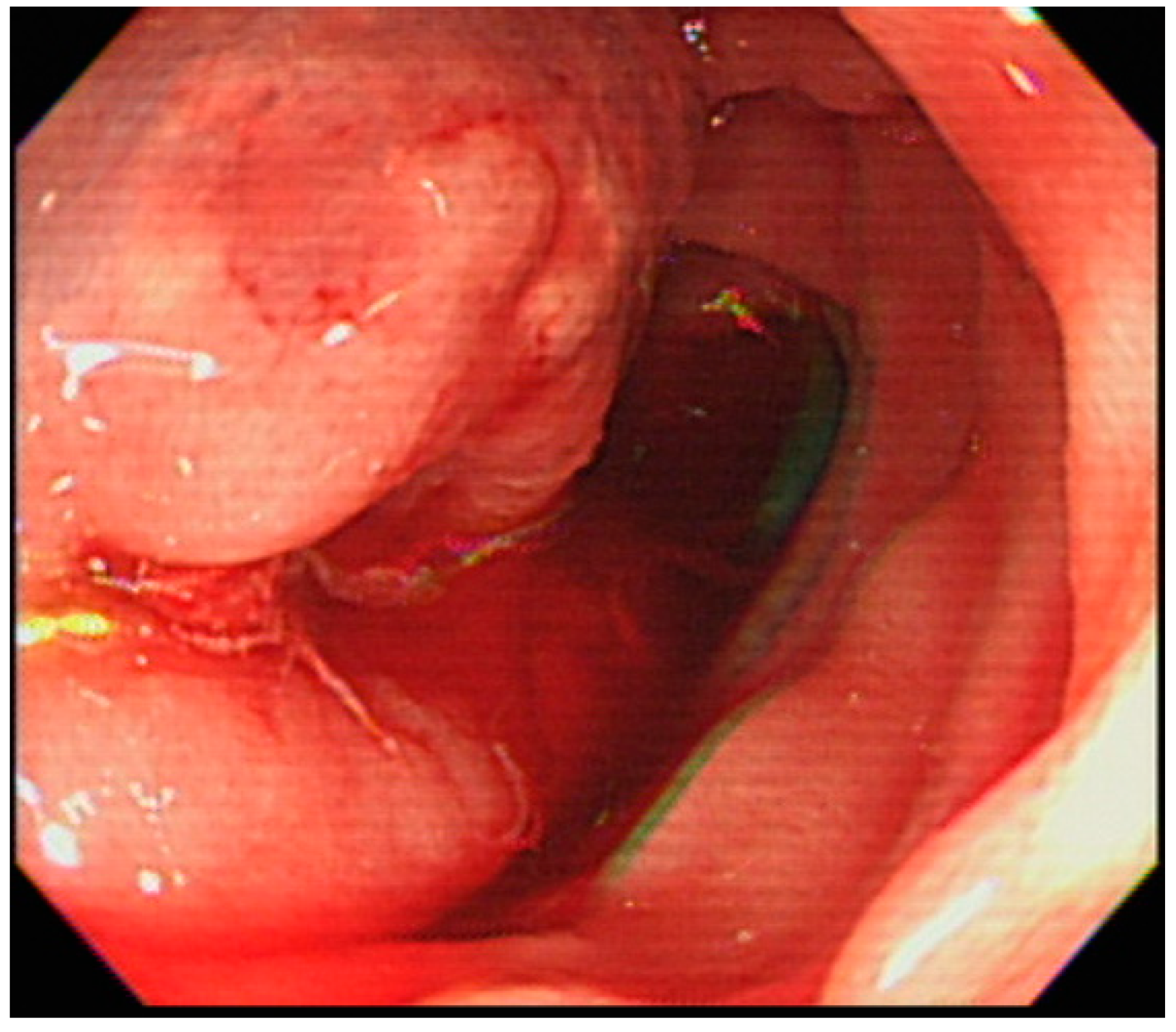 Medicina 54 00068 g002
