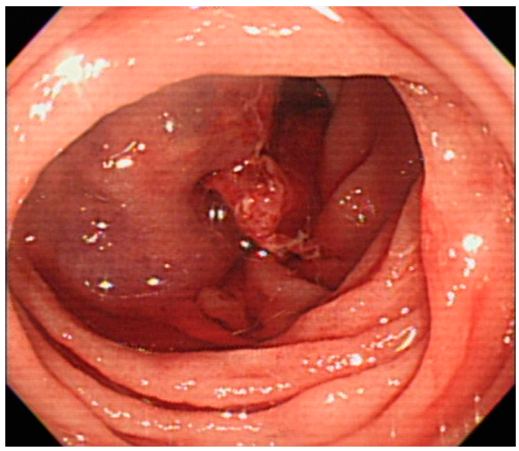 Medicina 54 00068 g003