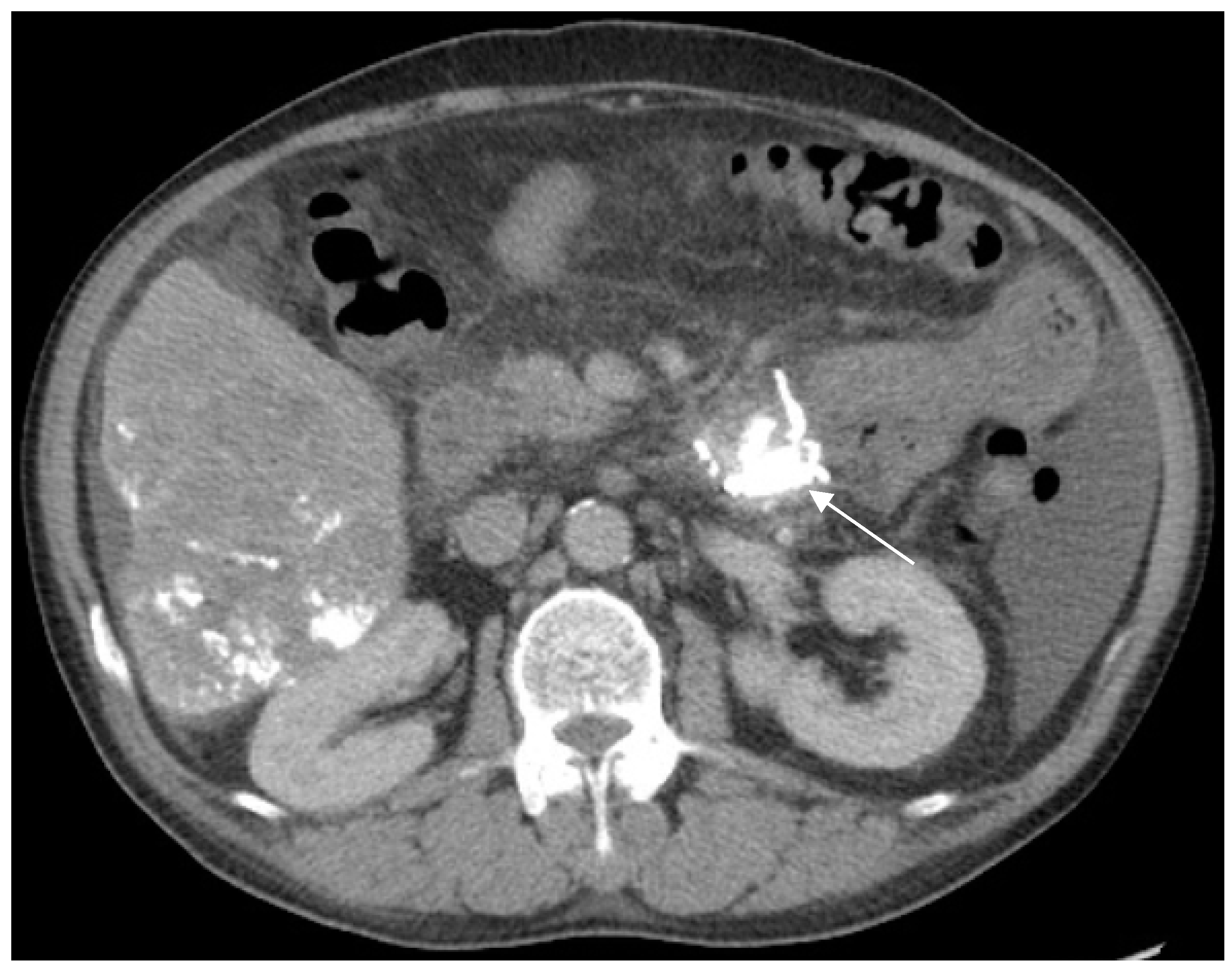 Medicina 54 00068 g004