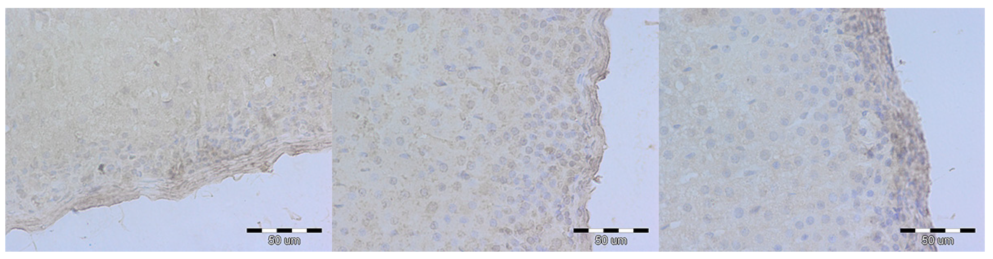 Medicina 54 00090 g004
