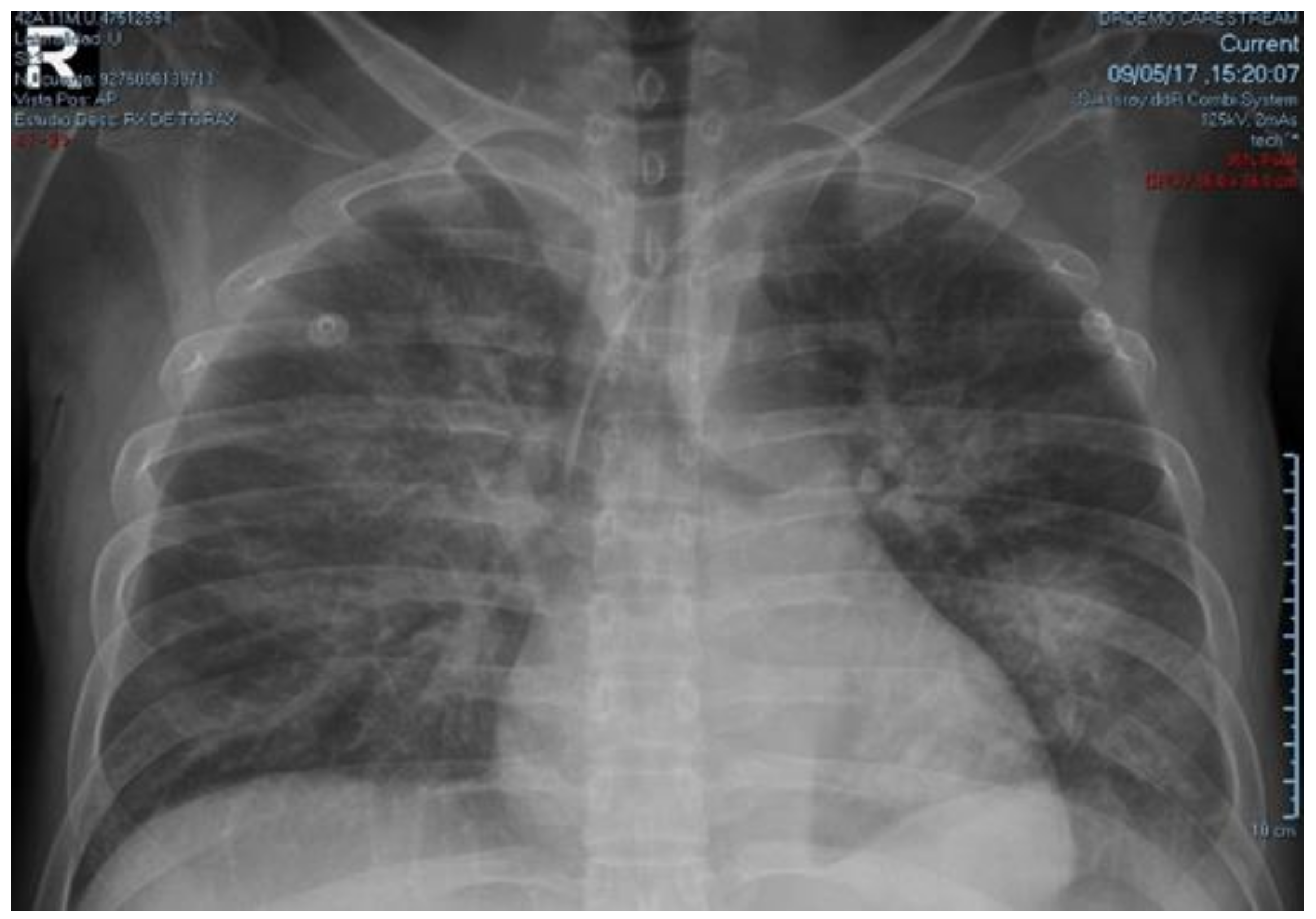 Medicina 54 00093 g002