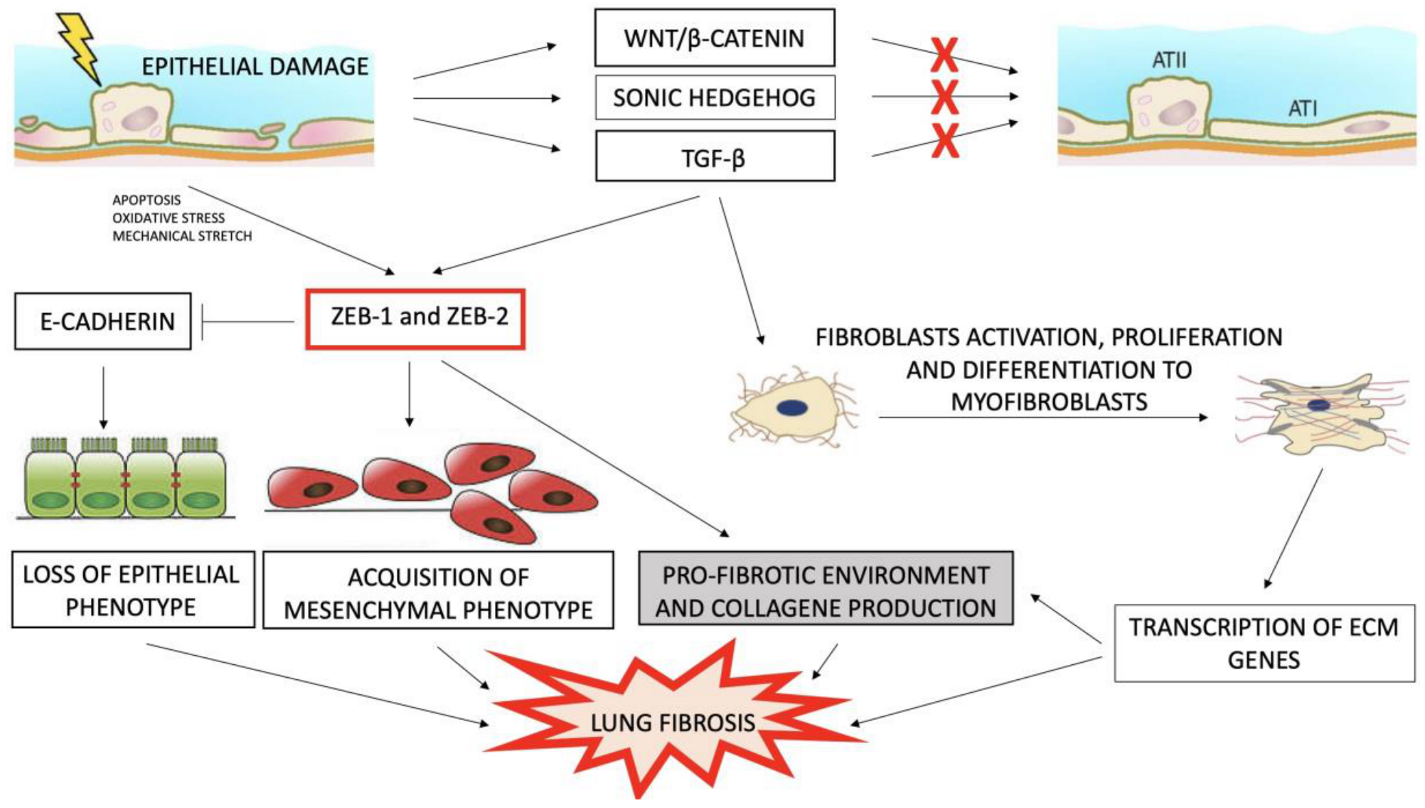 Medicina Free Full Text Epithelial Mesenchymal Transition In The Pathogenesis Of Idiopathic Pulmonary Fibrosis Html