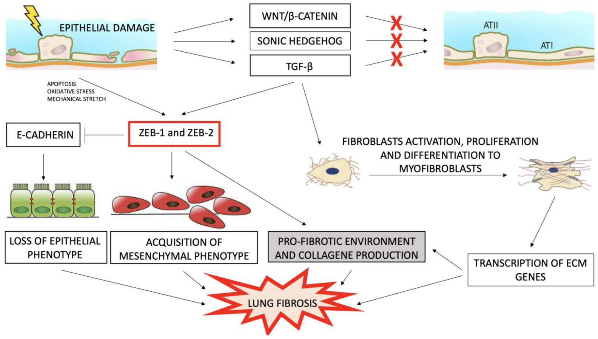 Medicina Free Full Text Epithelialmesenchymal - 